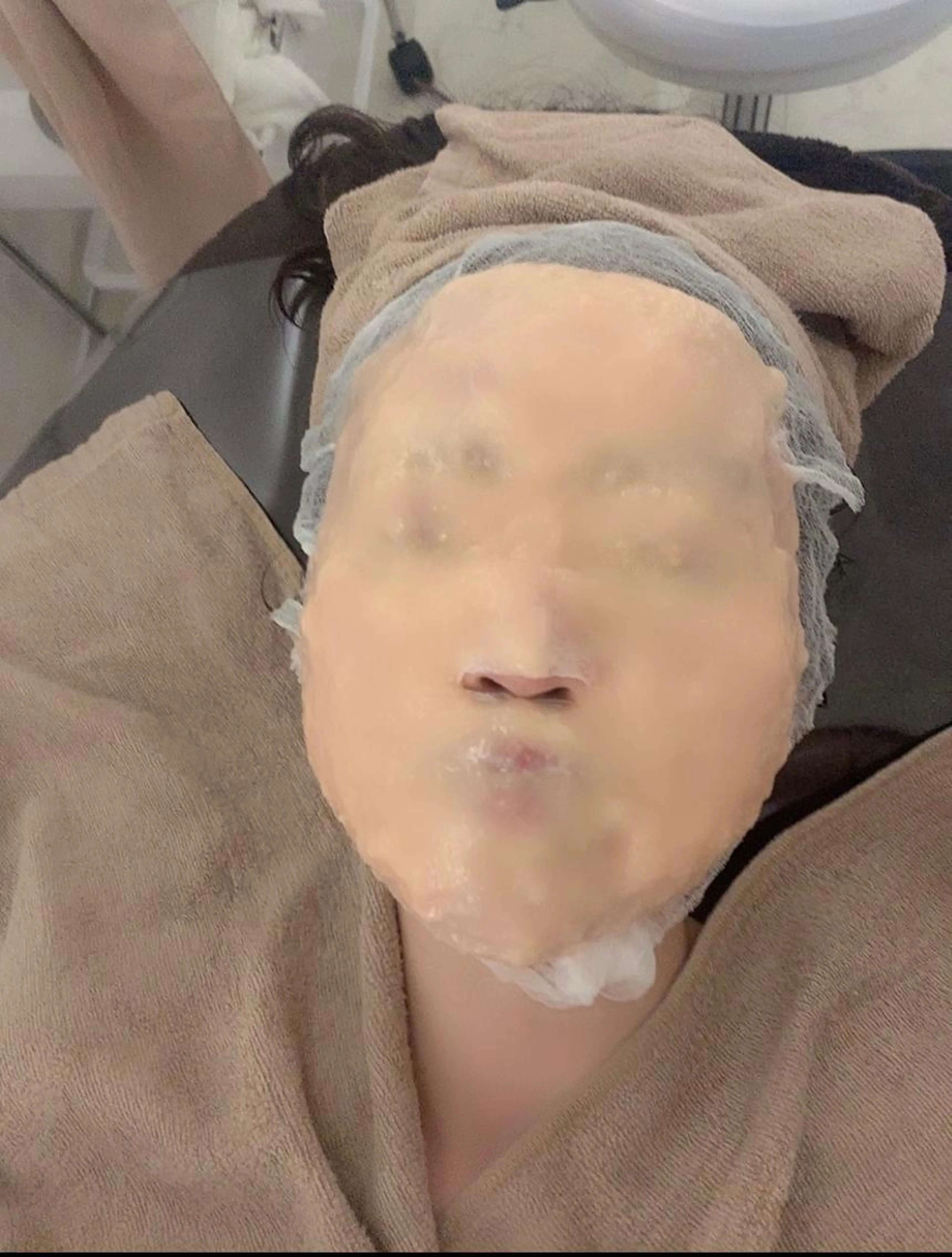 敏感ケアの写真