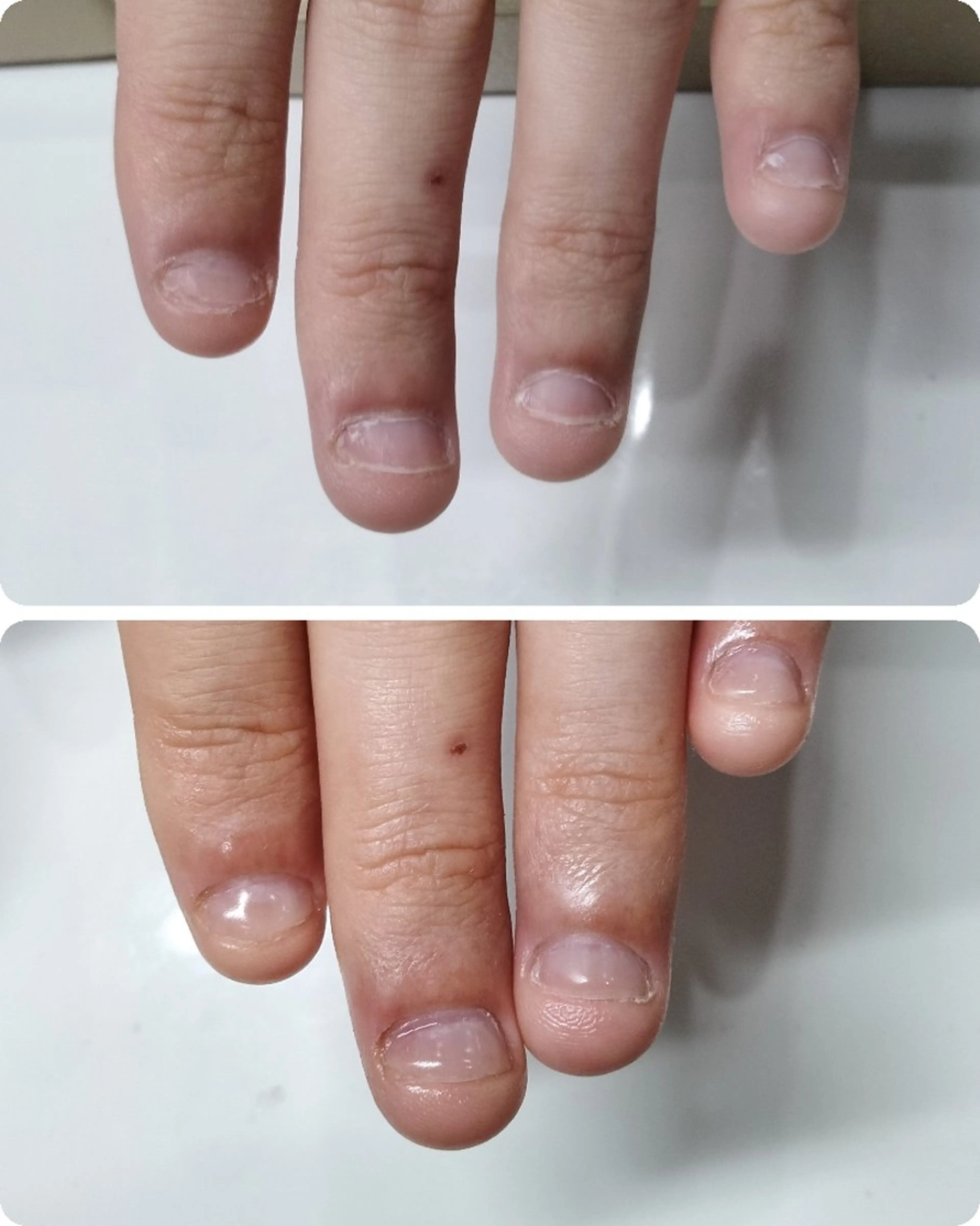 ネイル ハンドネイル ネイルサロンアリューム所属・ネイルサロン アリュームのネイルデザイン