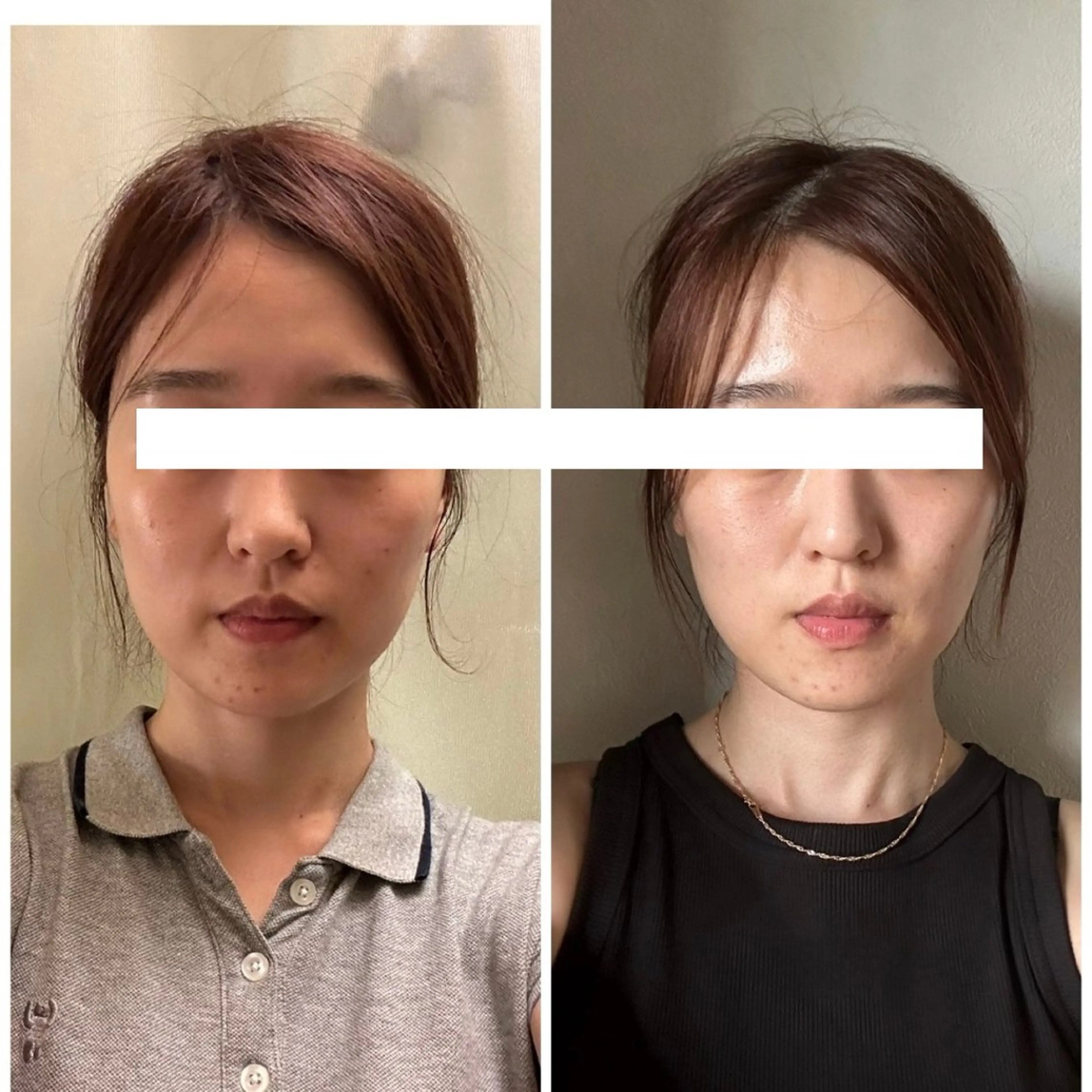 丸顔さんの救世主 高田 くみのエステ・リラクイメージ