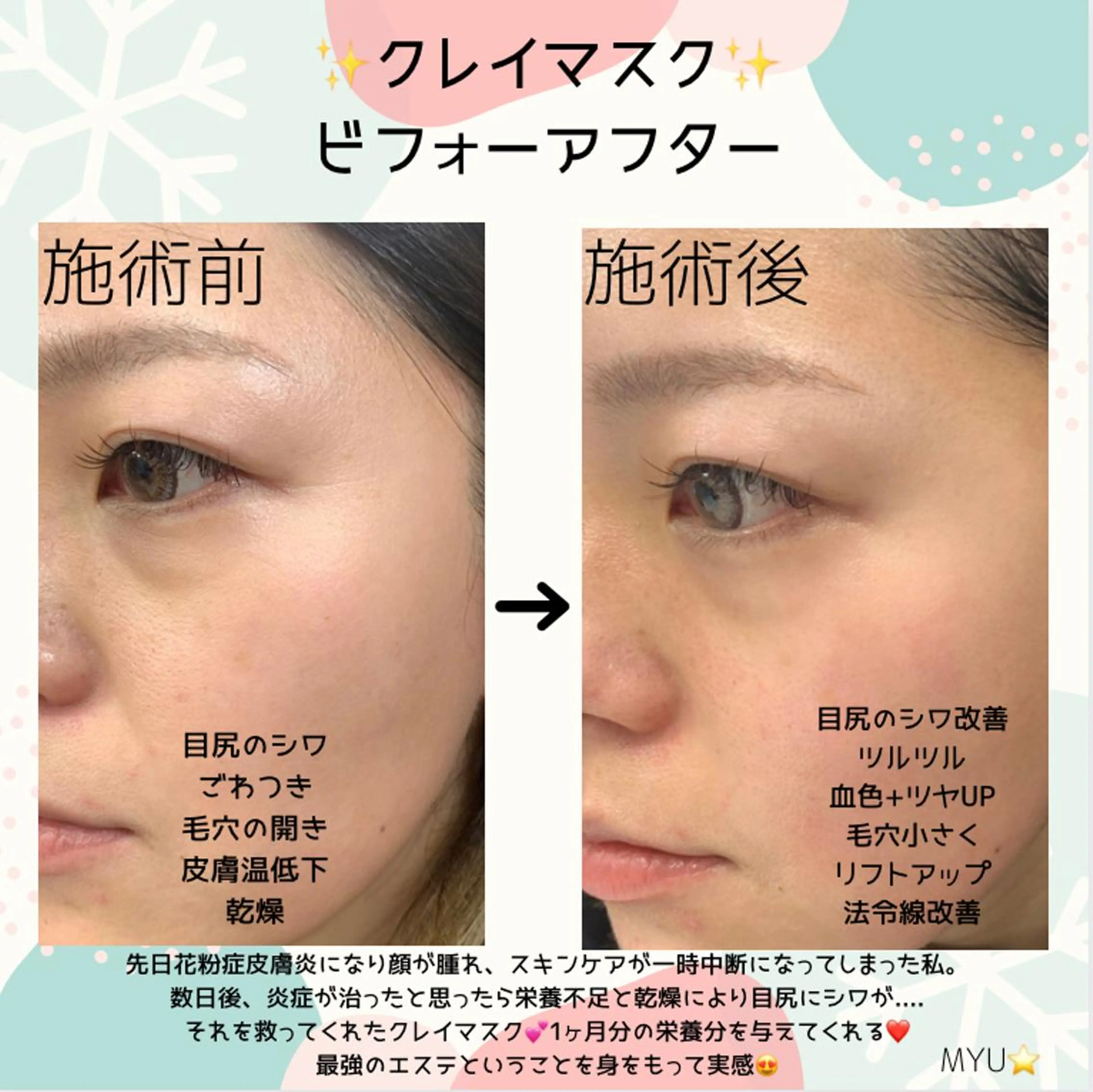 ミューズエステ 谷口美結のエステ・リラクイメージ