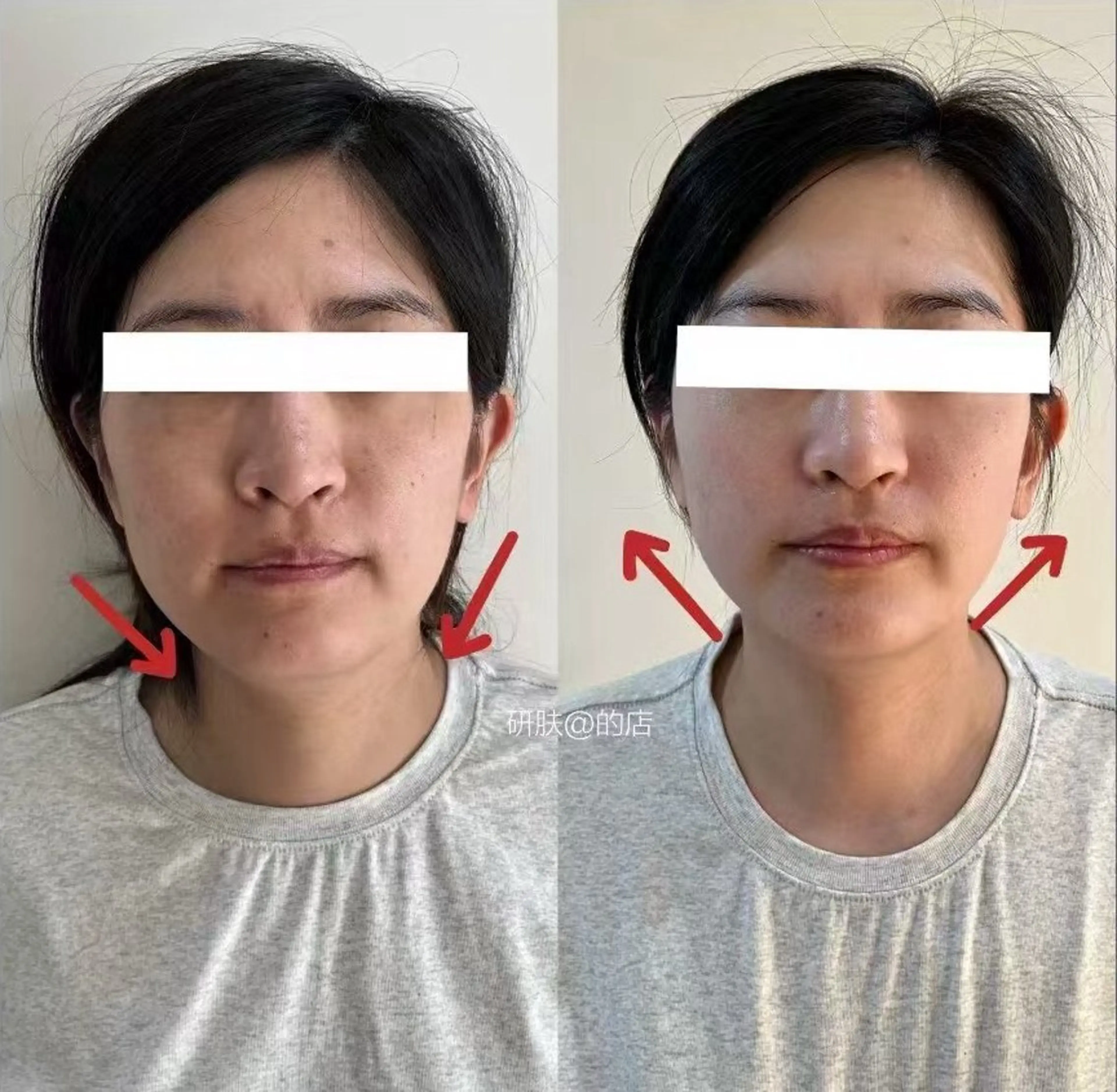 ショート aliaハーブ水光店 エステティシャン募集のエステ・リラクイメージ