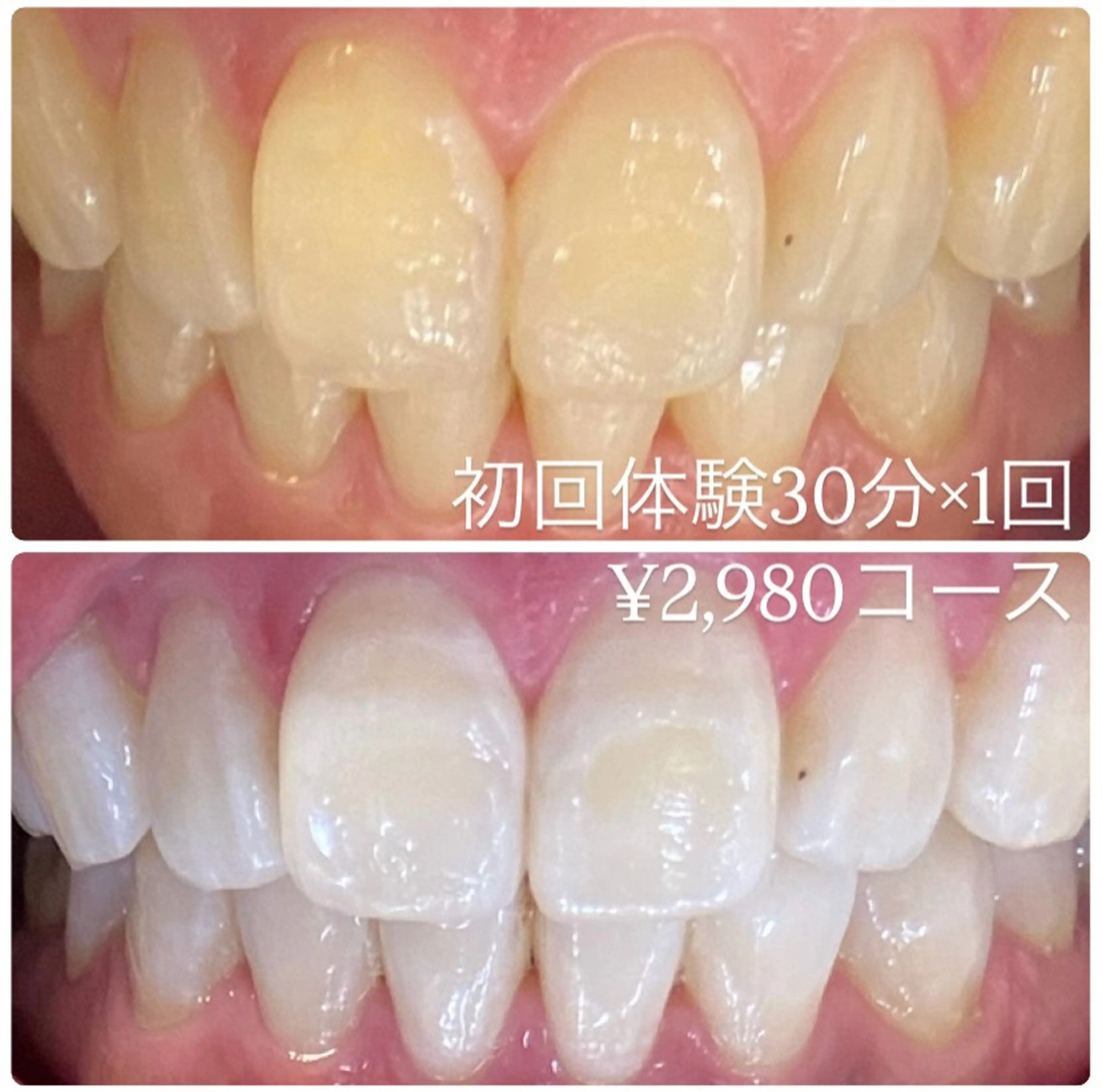 PLATINUM Beauty 横浜店所属・ホワイトニングルーム 横浜店のその他イメージ