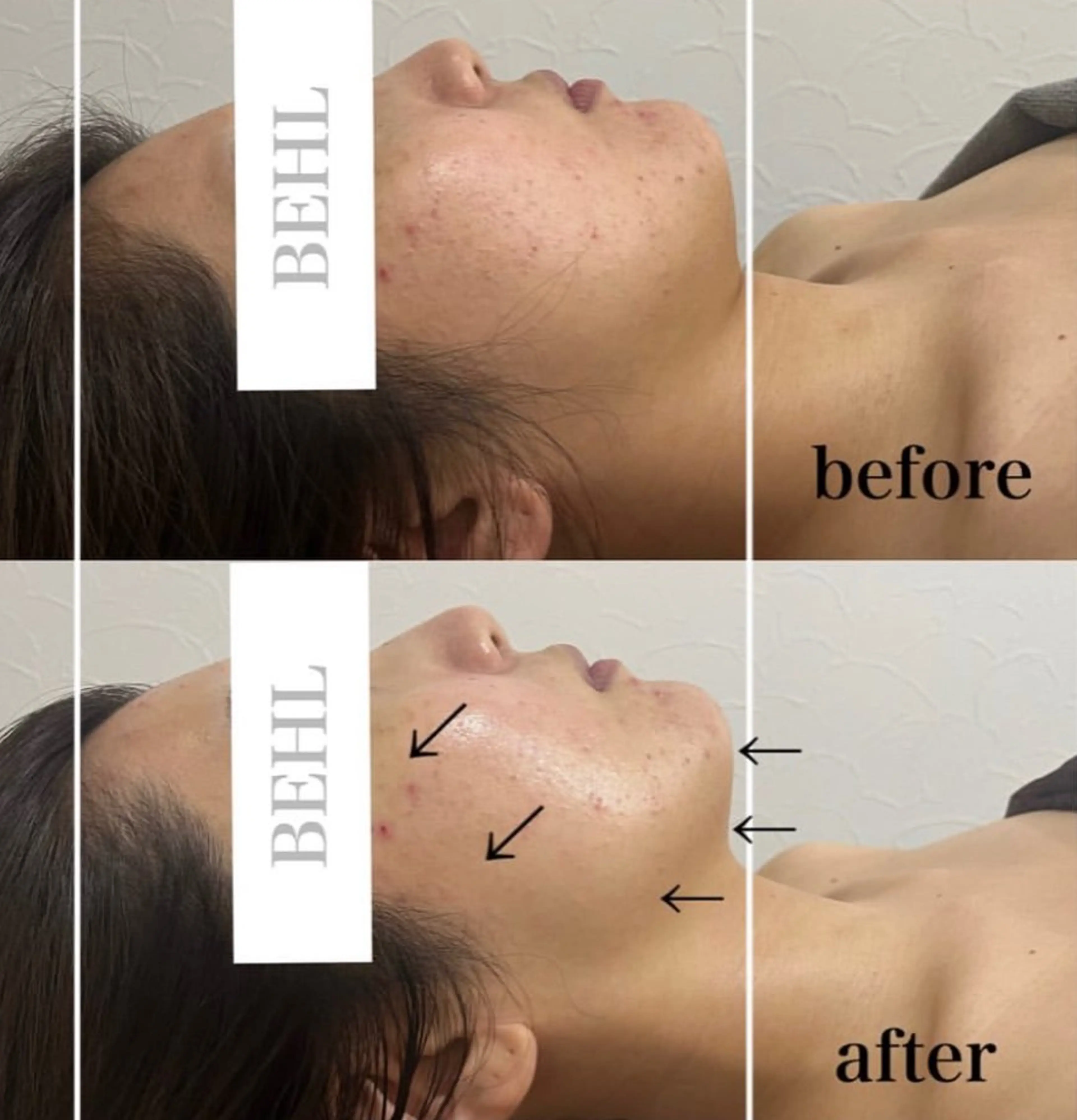 エステ BeautySalonBEHL所属・鶴ヶ島BEHL 村山のエステ・リラクイメージ