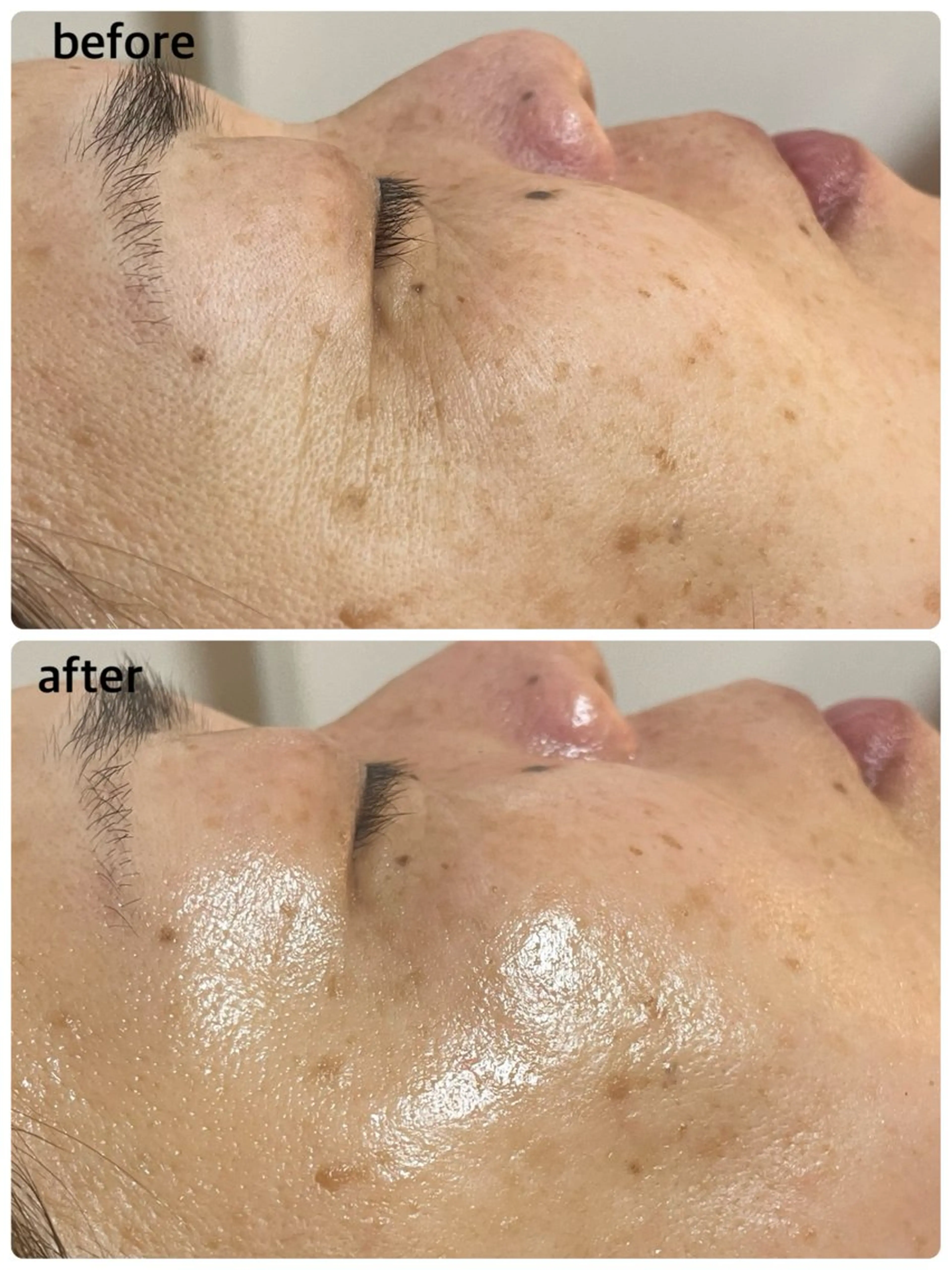 エステ 肌質改善専門店/絹々(きぬ)所属・心満たされる ハーブピーリング絹々のエステ・リラクイメージ