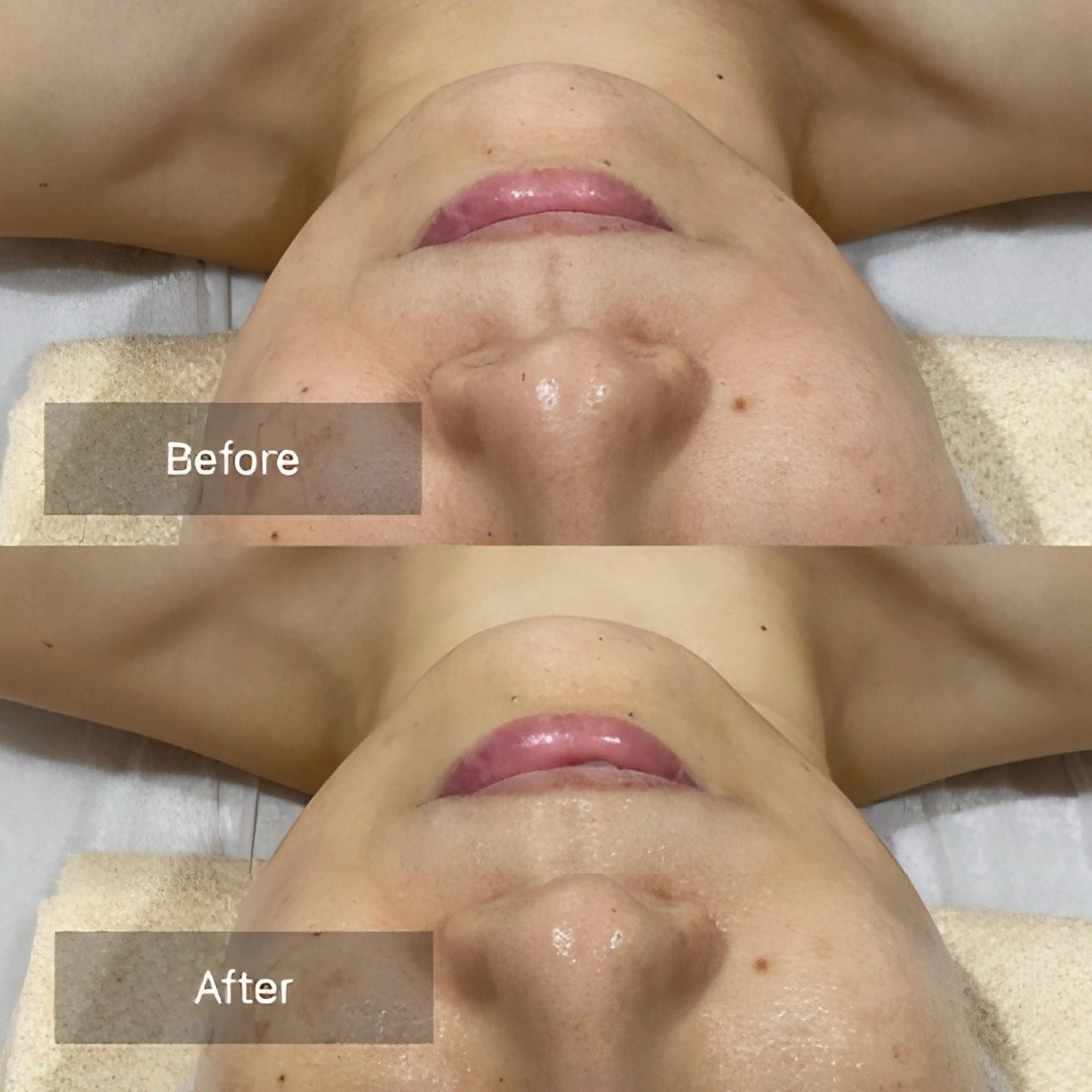 エステ リンパサロン mercicocoのエステ・リラクイメージ