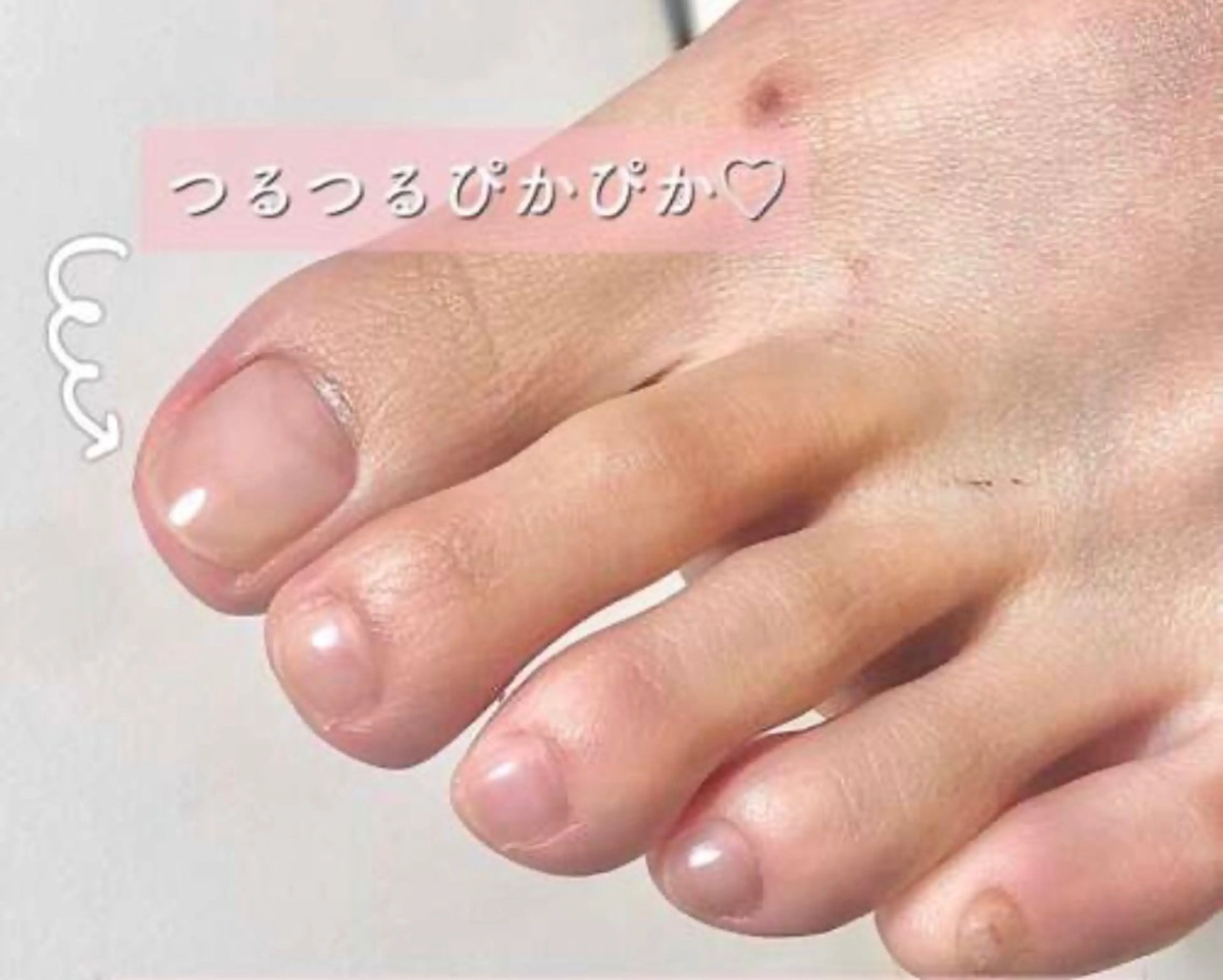 ［爪ケアコース]の写真