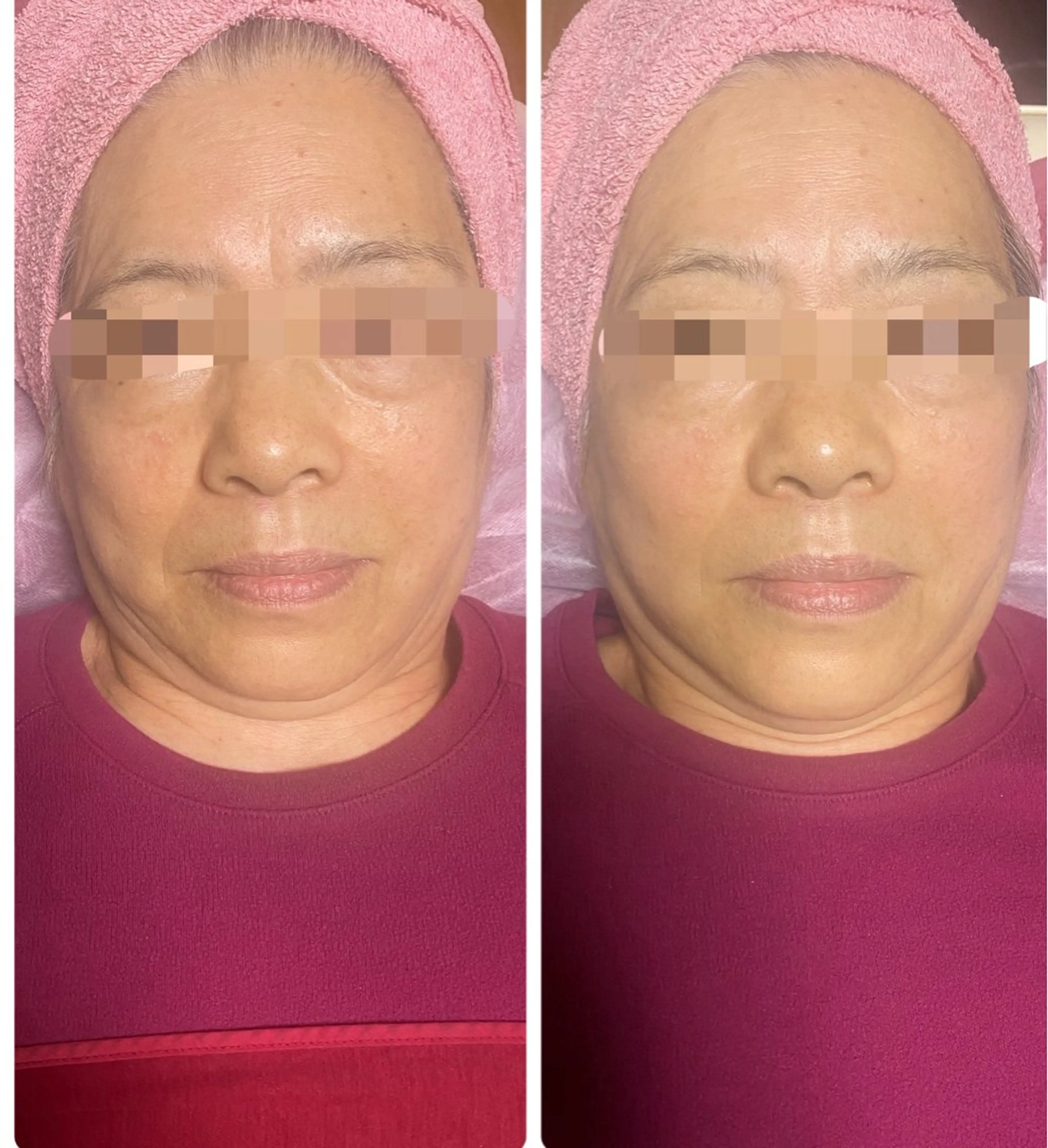 その他 金納 まゆみのエステ・リラクイメージ