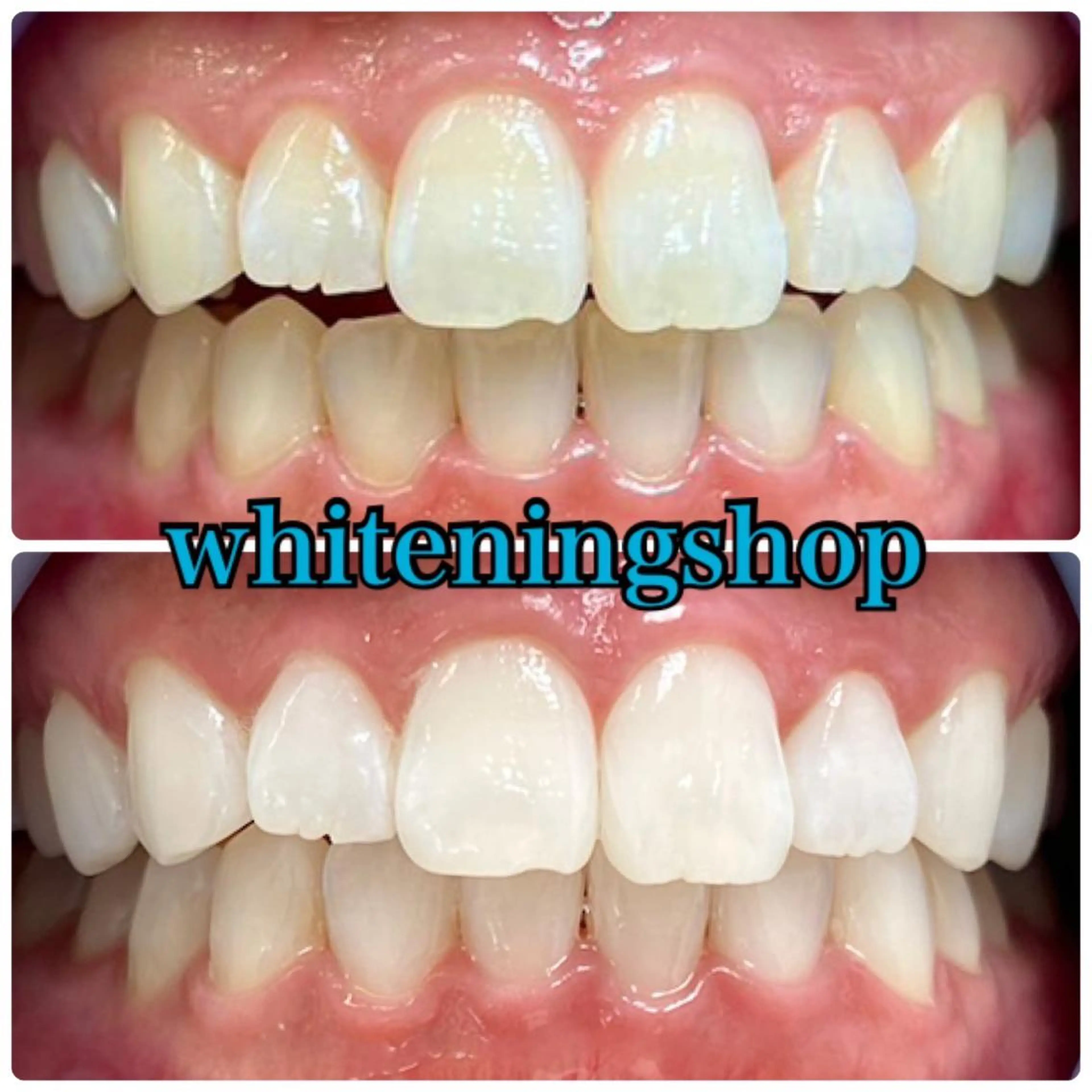 ホワイトニング ショップ吉祥寺店のエステ・リラクイメージ