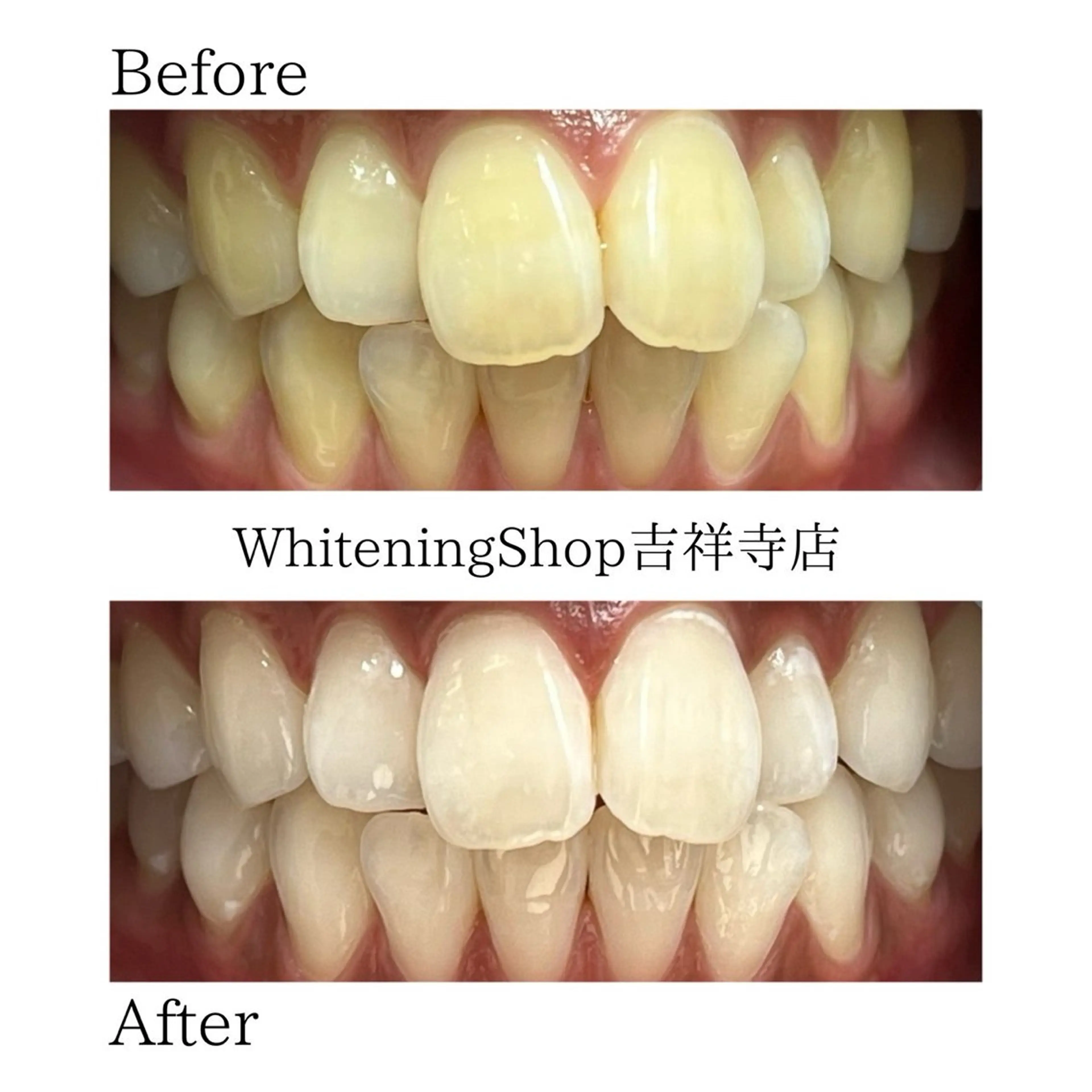 エステ リラク ホワイトニング ショップ吉祥寺店のエステ・リラクイメージ