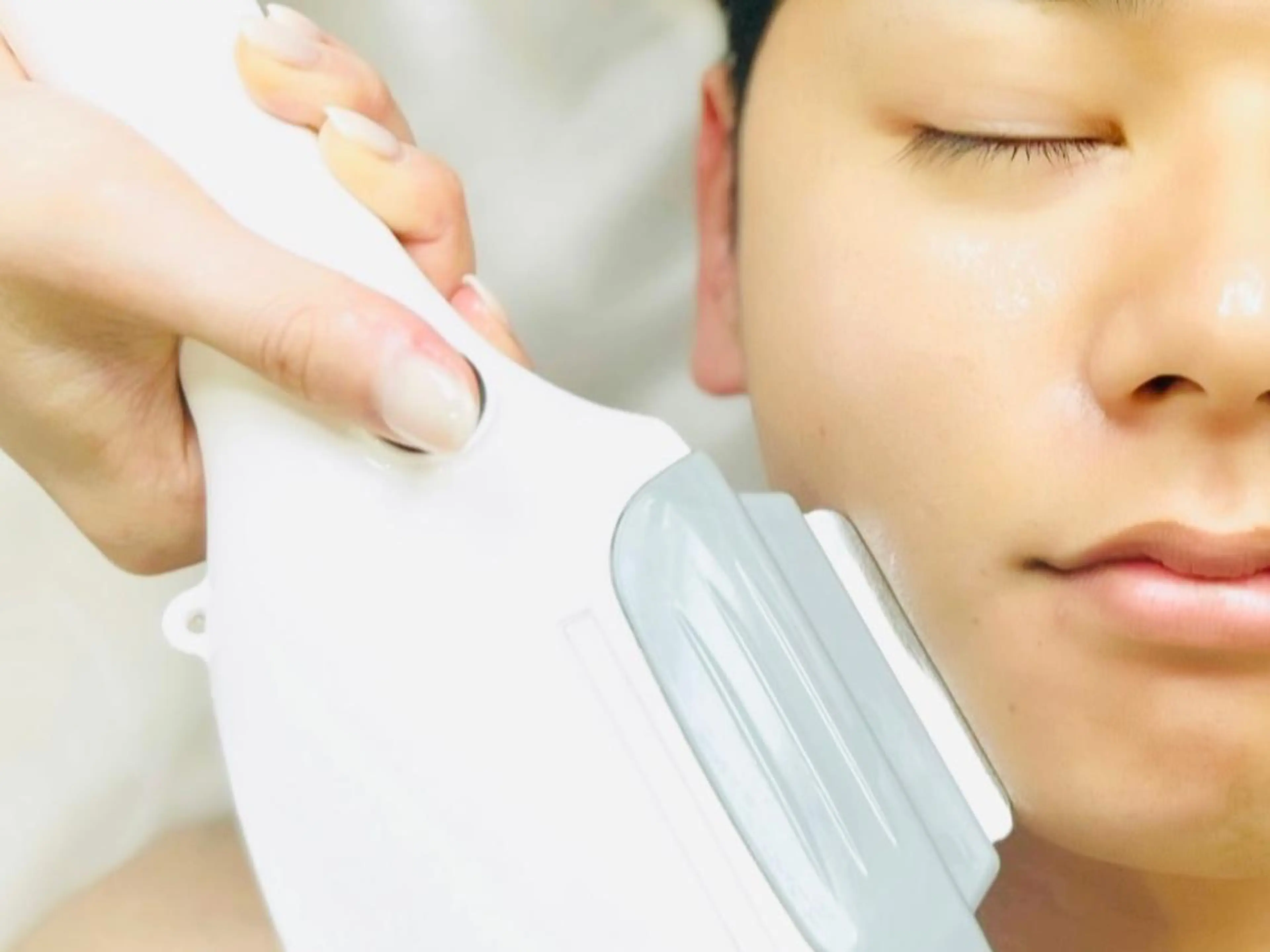 メンズ髭脱毛! 2500円♪毎日のシェービングがなくなるだけでとっても楽に!青髭卒業しましょう!モテ肌スベスベにの写真