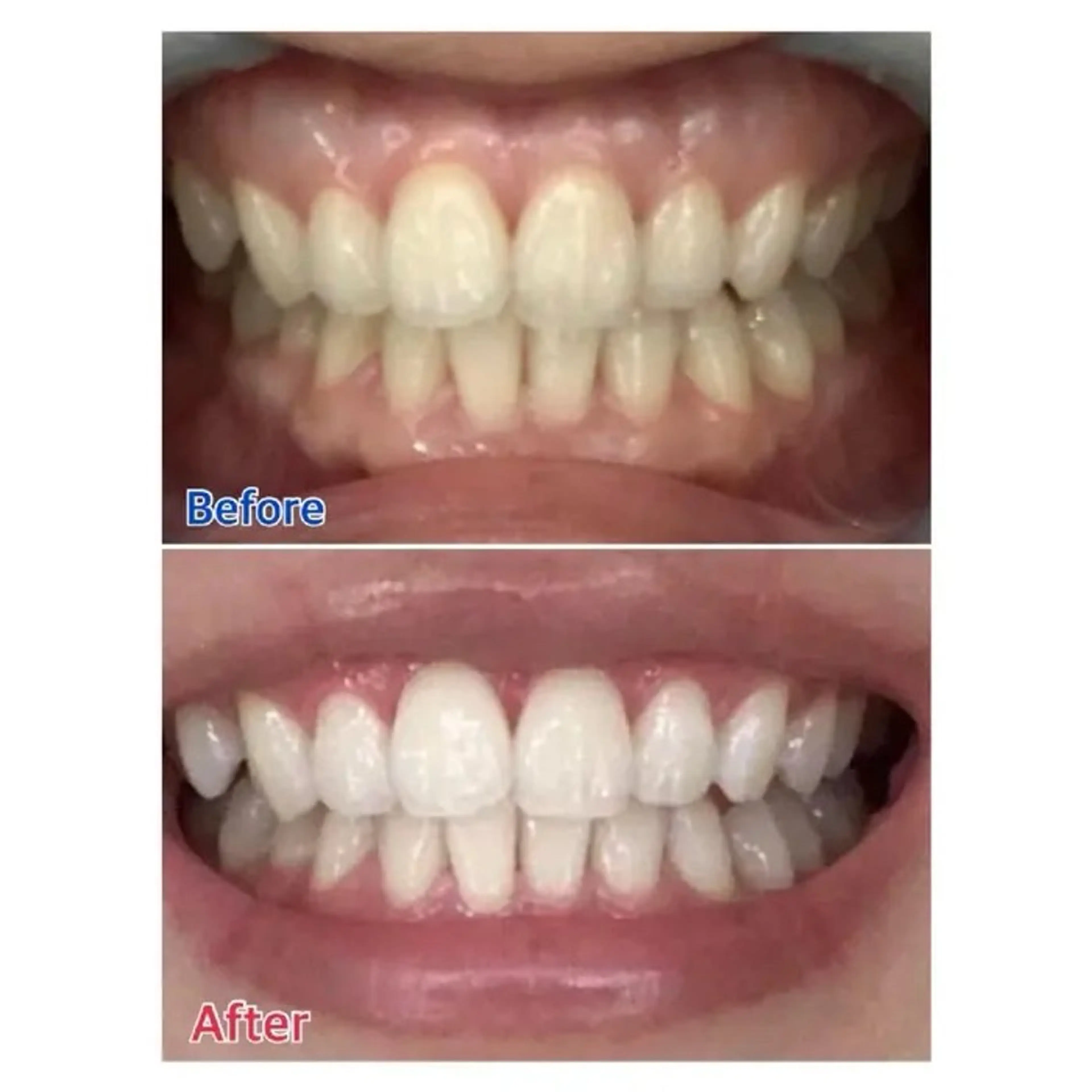 M渋谷 ホワイトニングのエステ・リラクイメージ