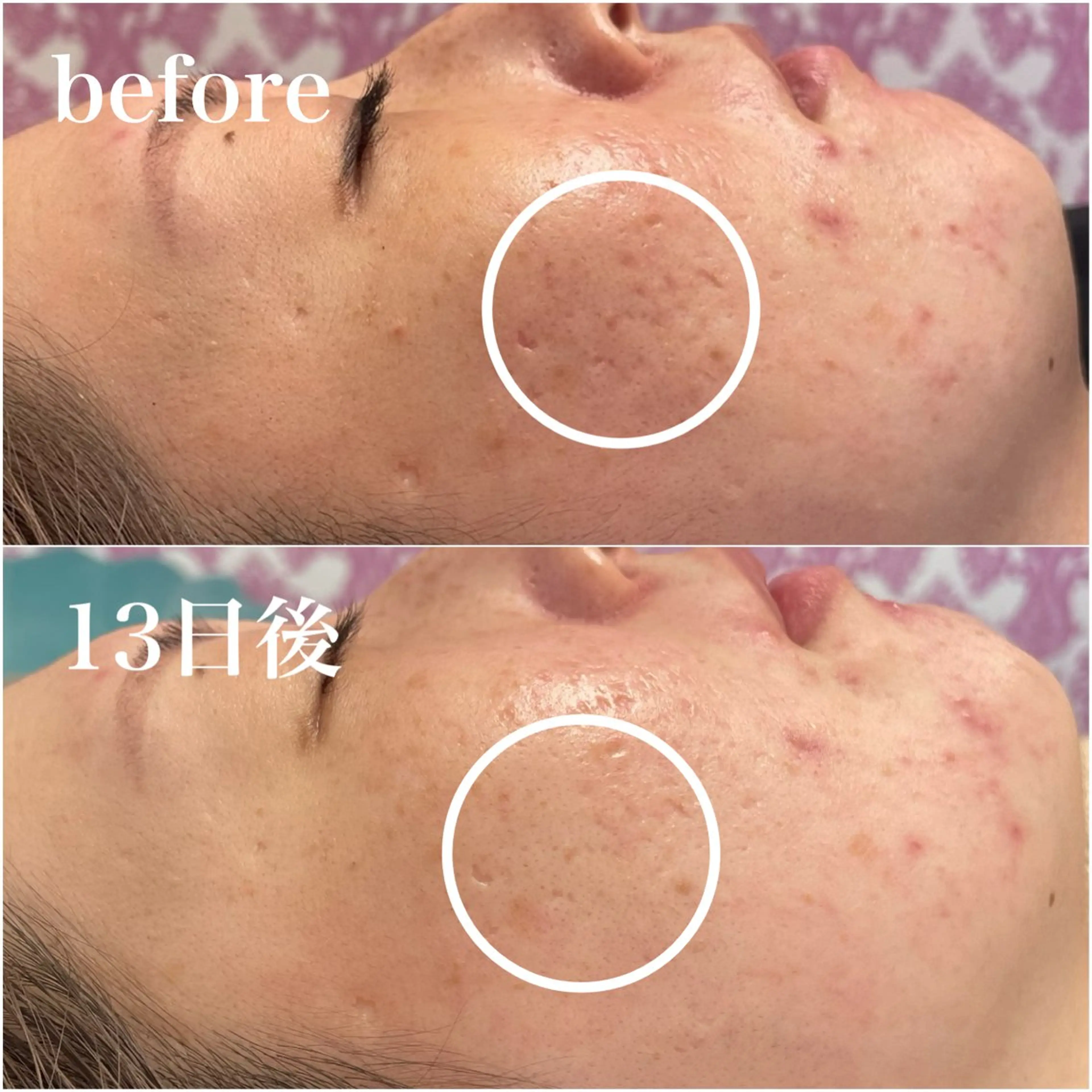 毛穴レス ハーブ& ワックス脱毛×光脱毛のエステ・リラクイメージ