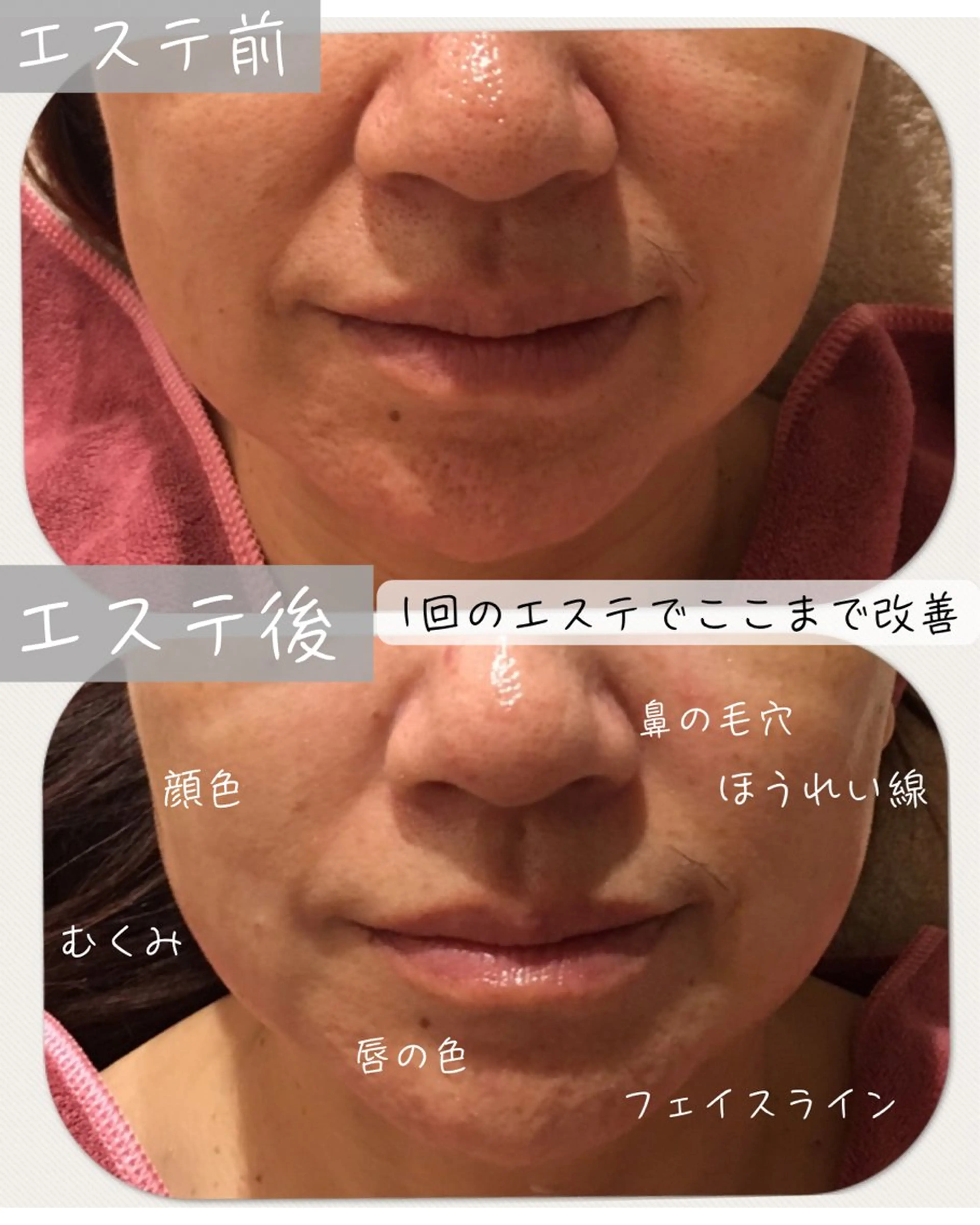 エステ 全ての女性の体と肌に 鈴木　千紗のエステ・リラクイメージ