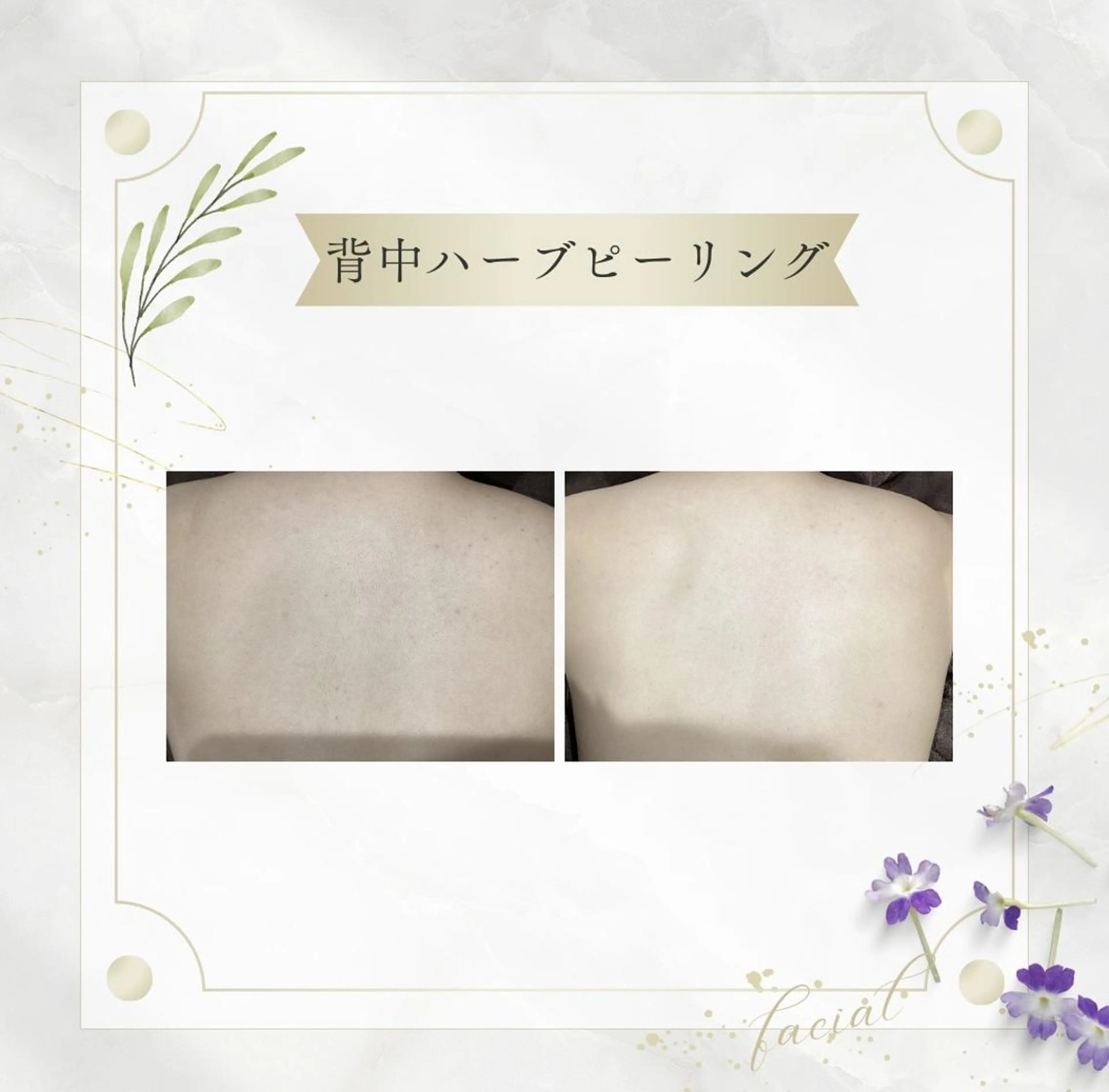 《 肌質×美肌 》 addissimoのエステ・リラクイメージ