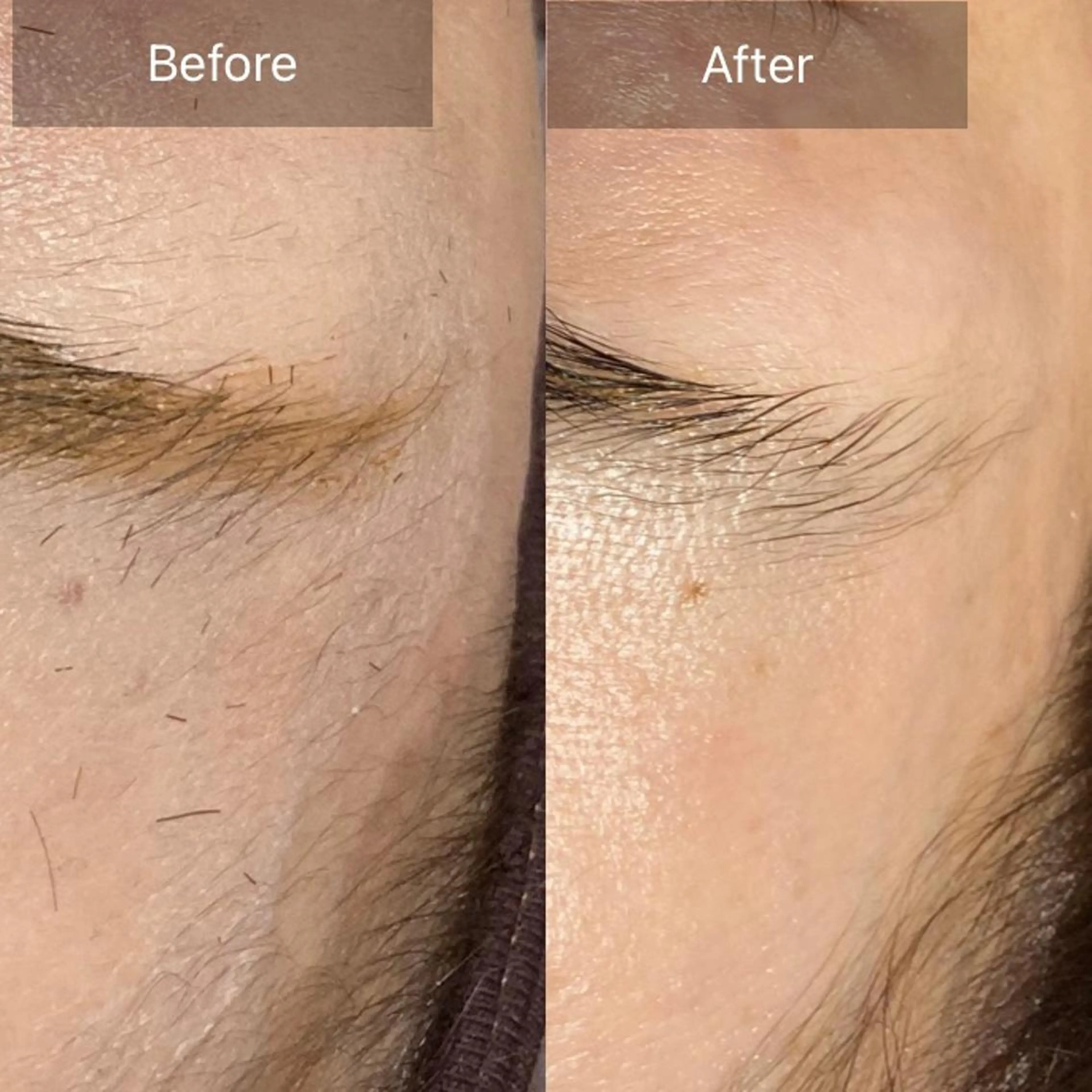 脱毛 産毛専門店 Bittoのエステ・リラクイメージ