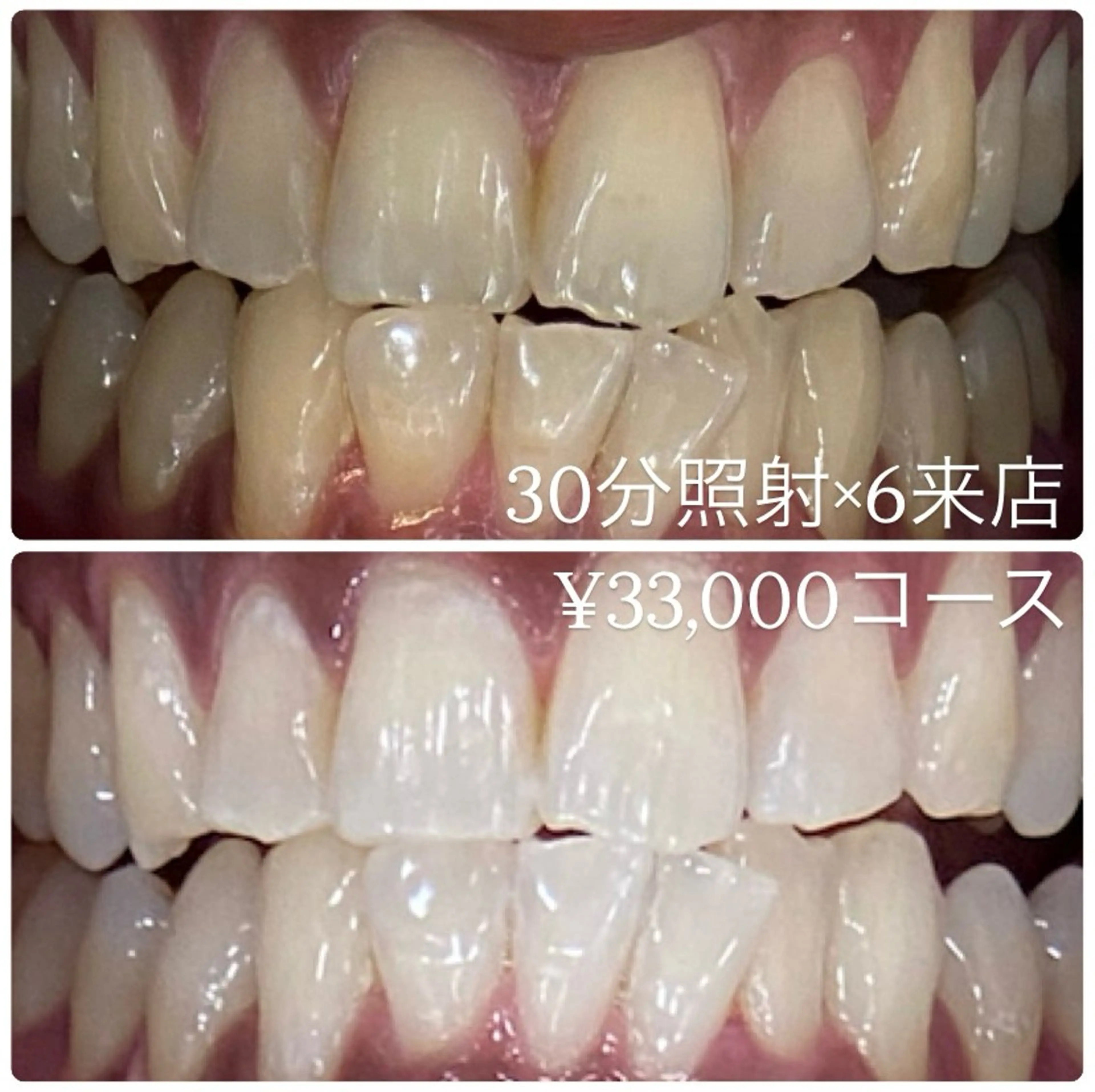 ホワイトニングルーム 横浜店のその他イメージ