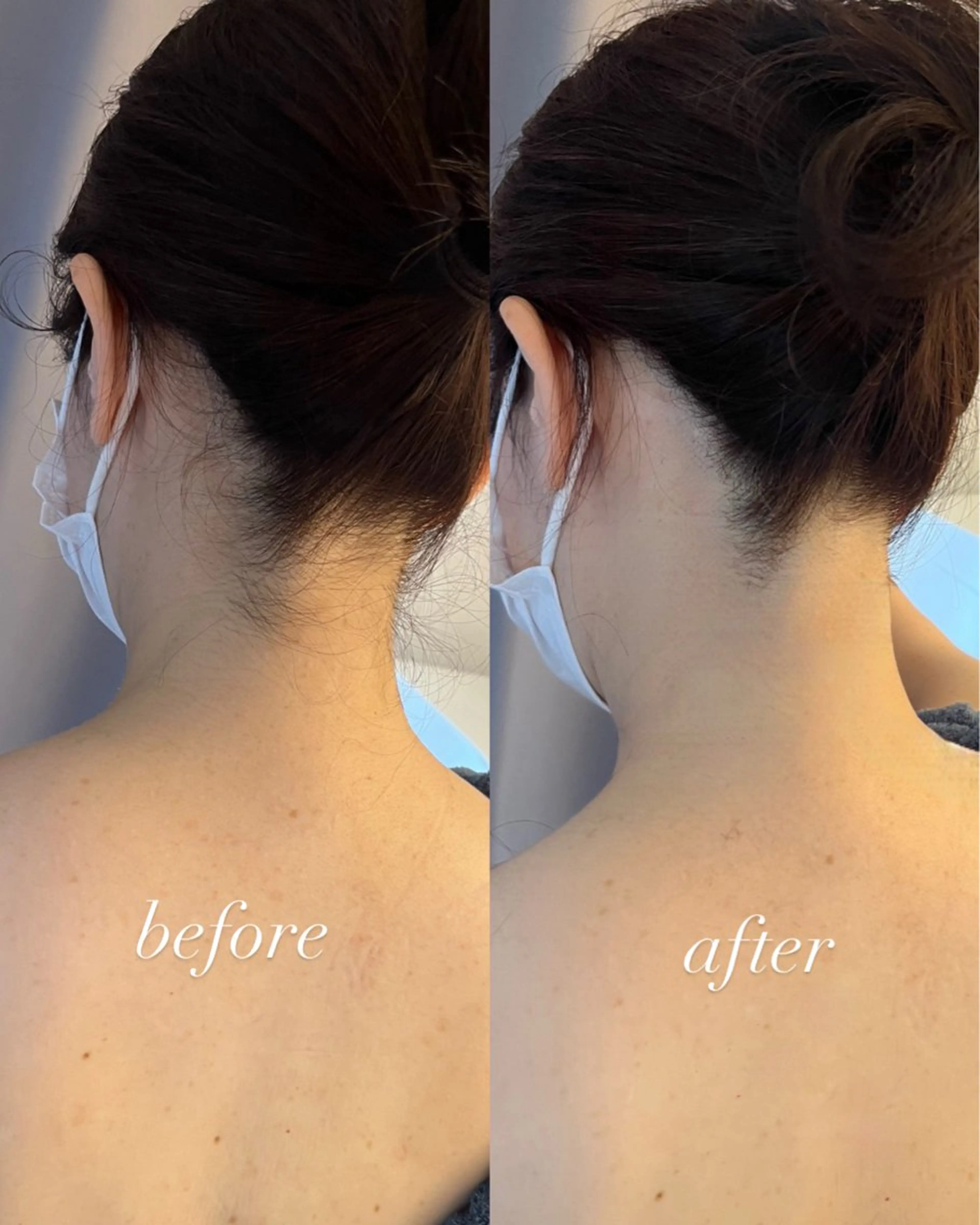 うなじ脱毛/美肌脱毛 LABELのエステ・リラクイメージ