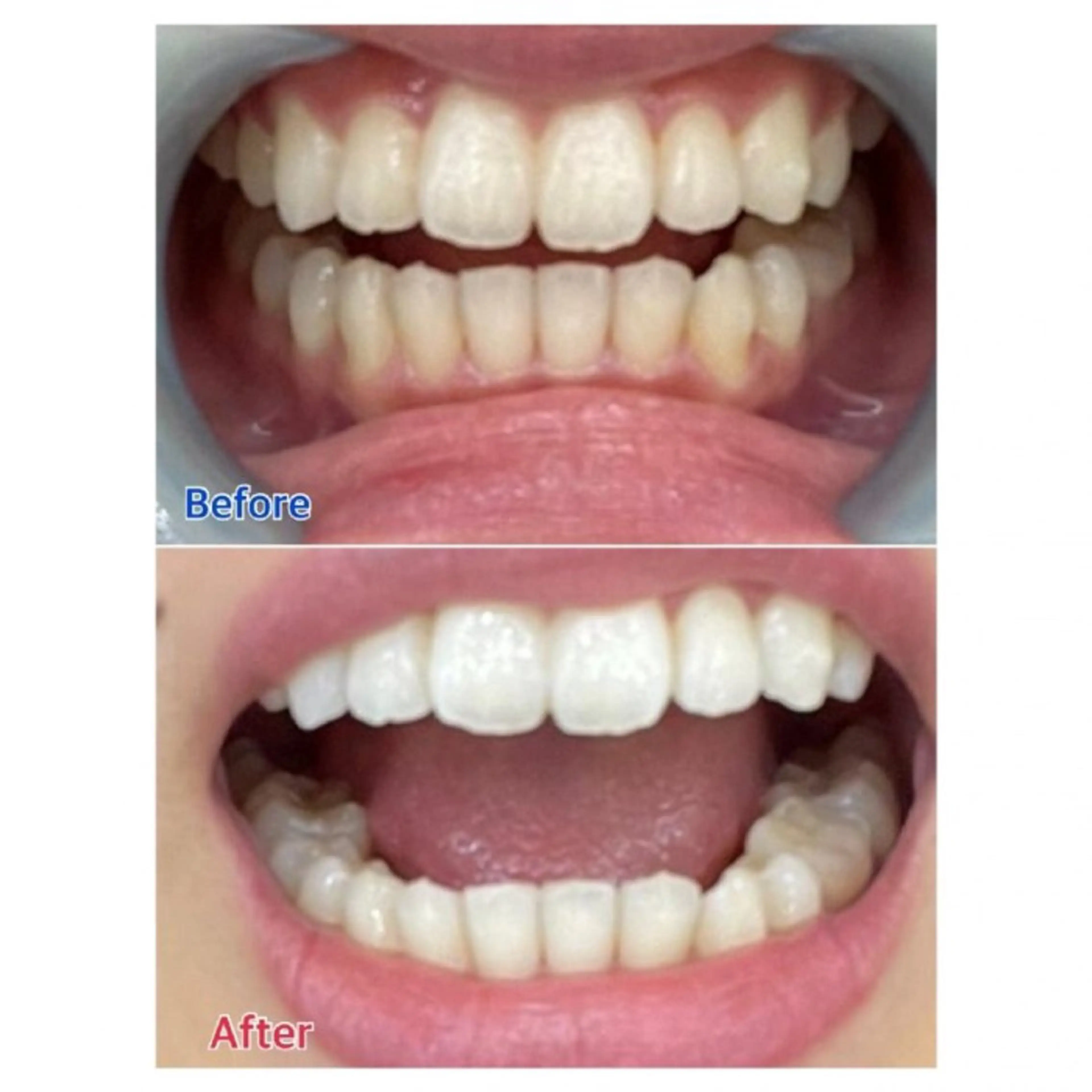 Ｍ渋谷 ホワイトニングのエステ・リラクイメージ