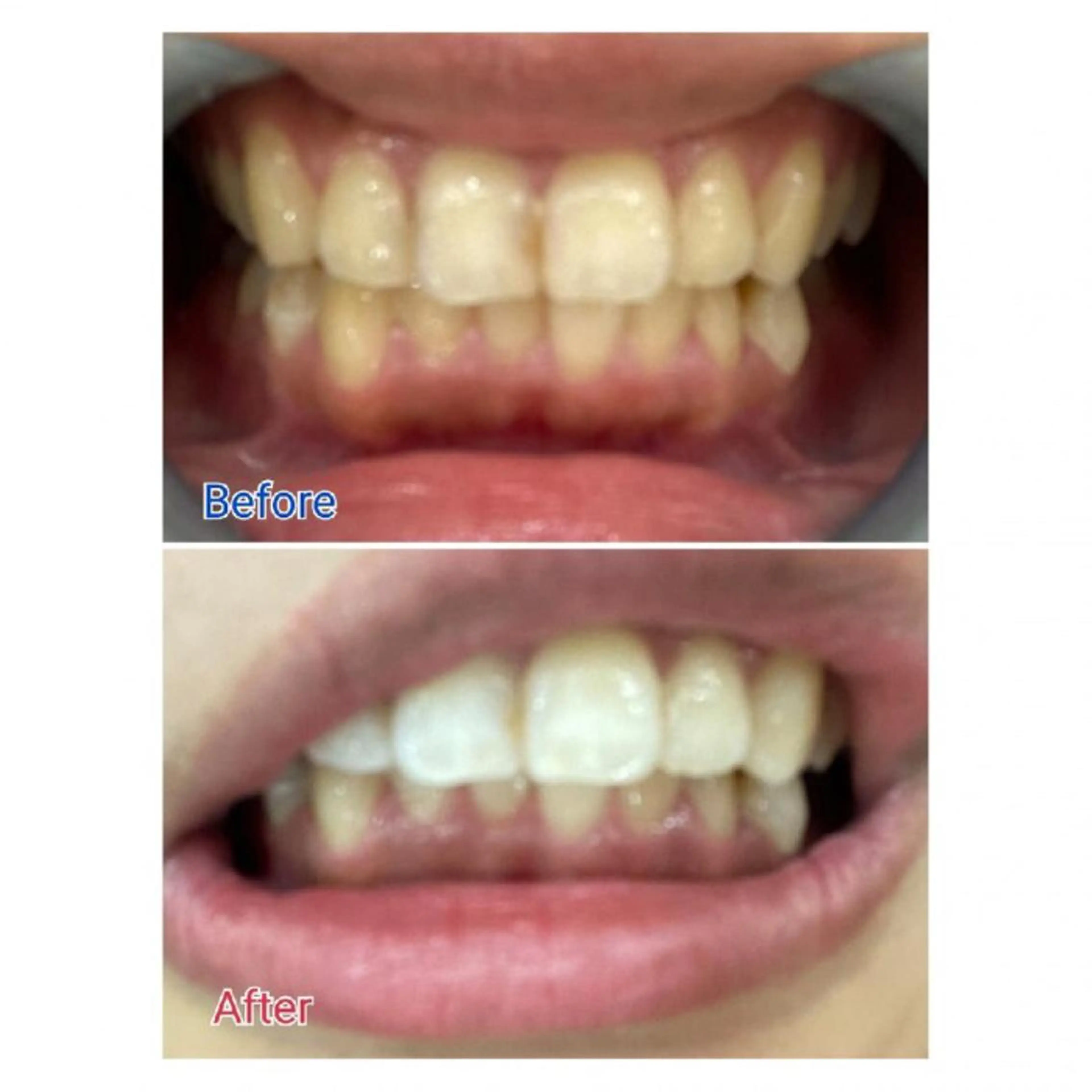 Ｍ渋谷 ホワイトニングのエステ・リラクイメージ