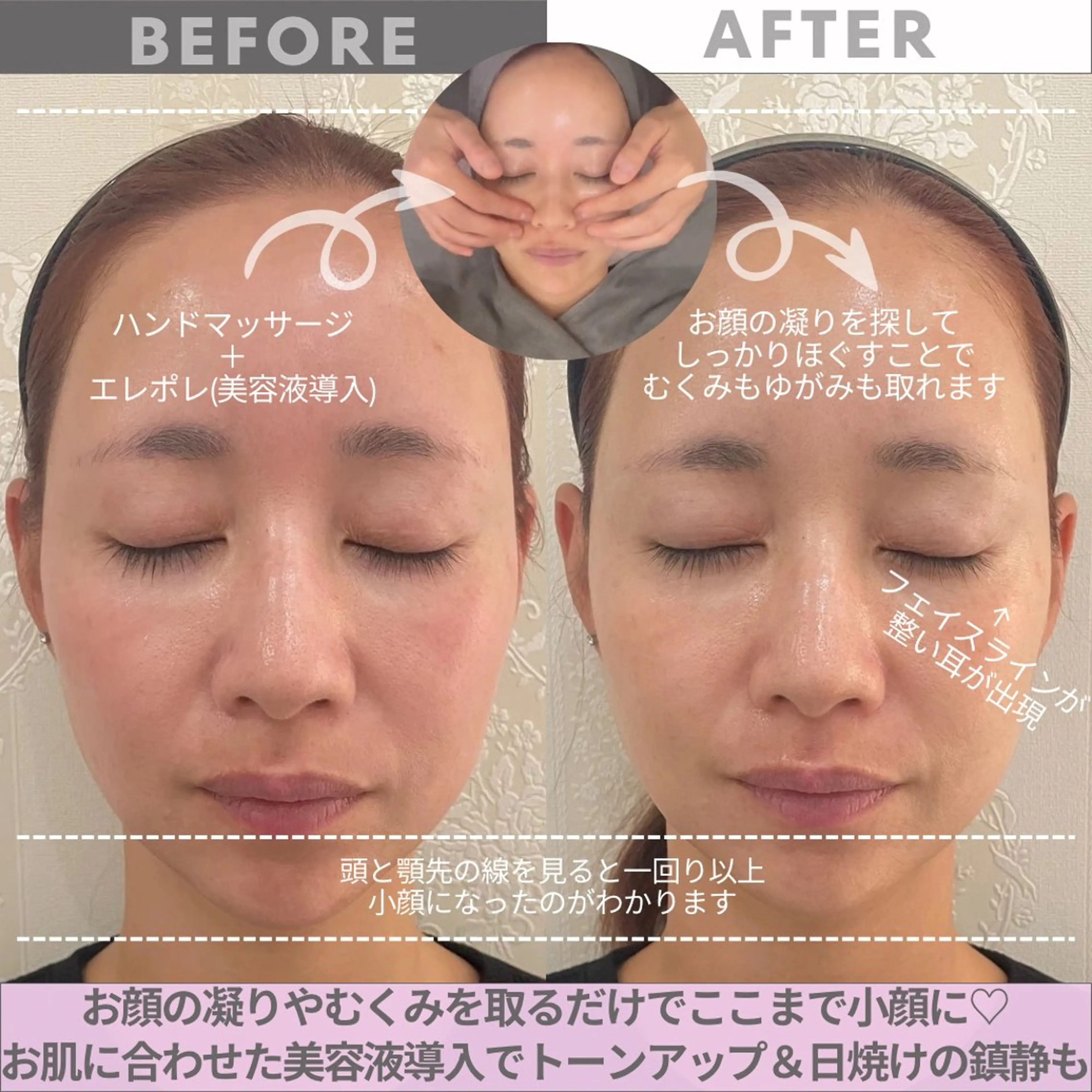 リンデザ 山口のエステ・リラクイメージ