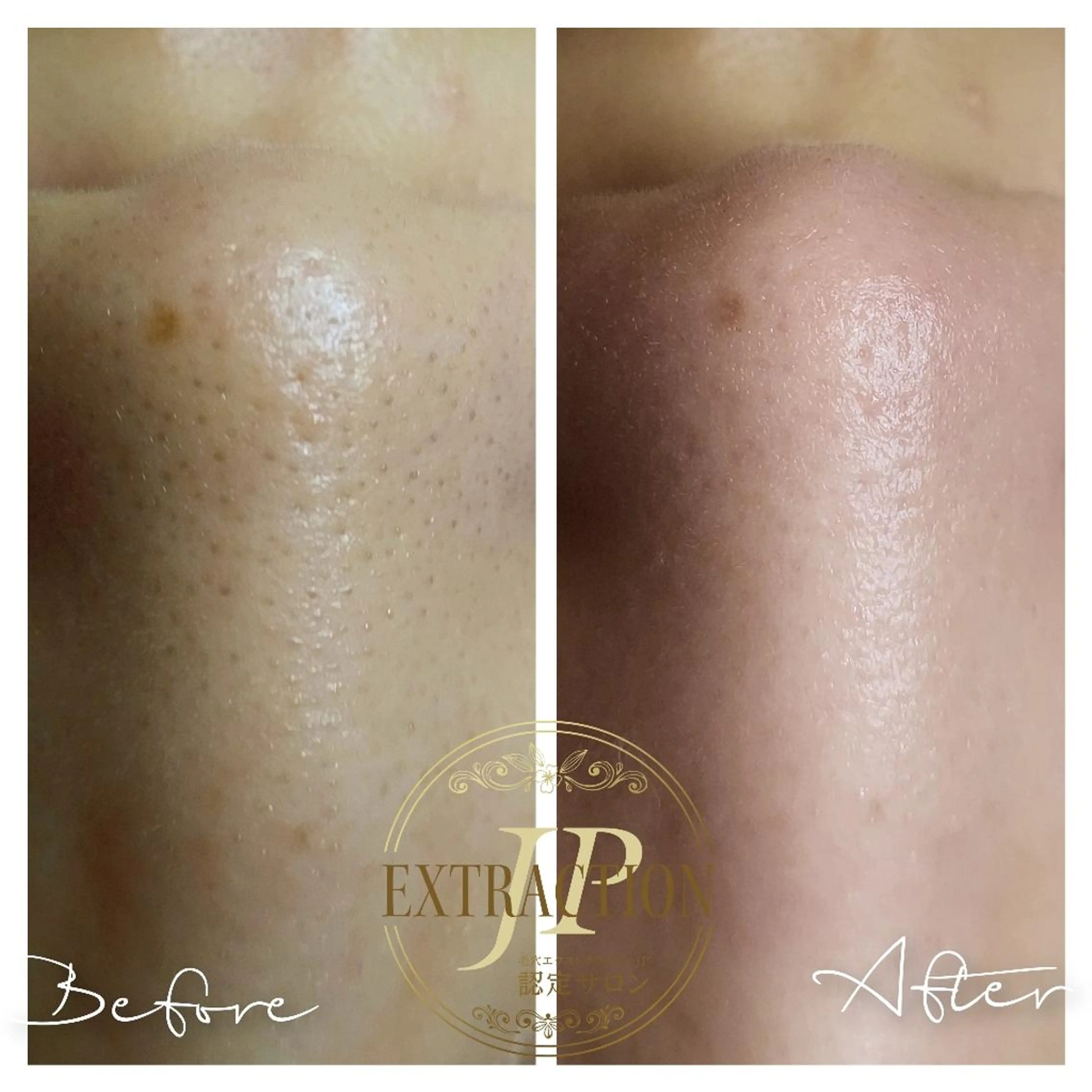 エステ エステサロン　Lazulisea所属・川口 春奈のエステ・リラクイメージ