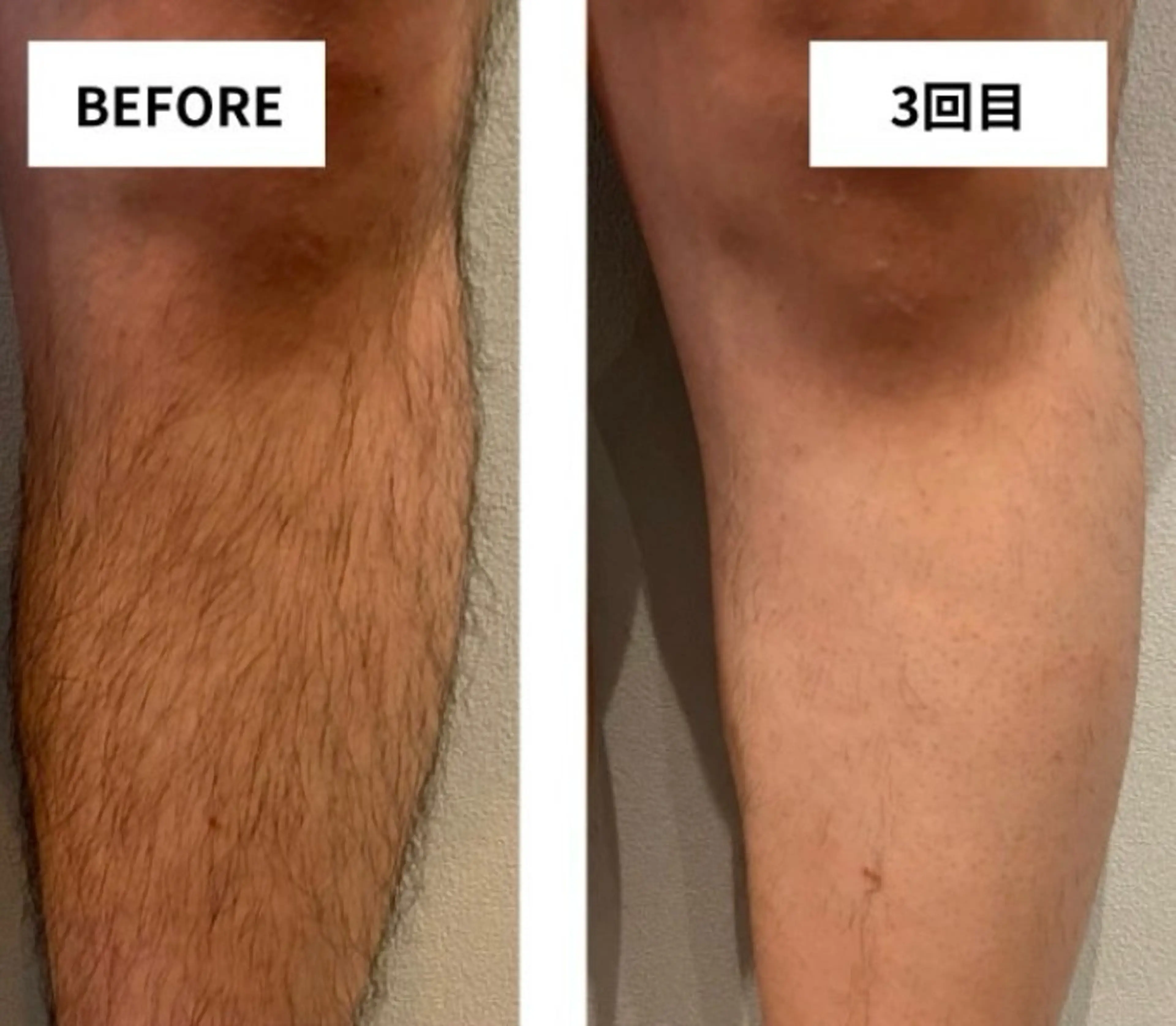 メンズ im所属・nagasawa asukaのネイルデザイン