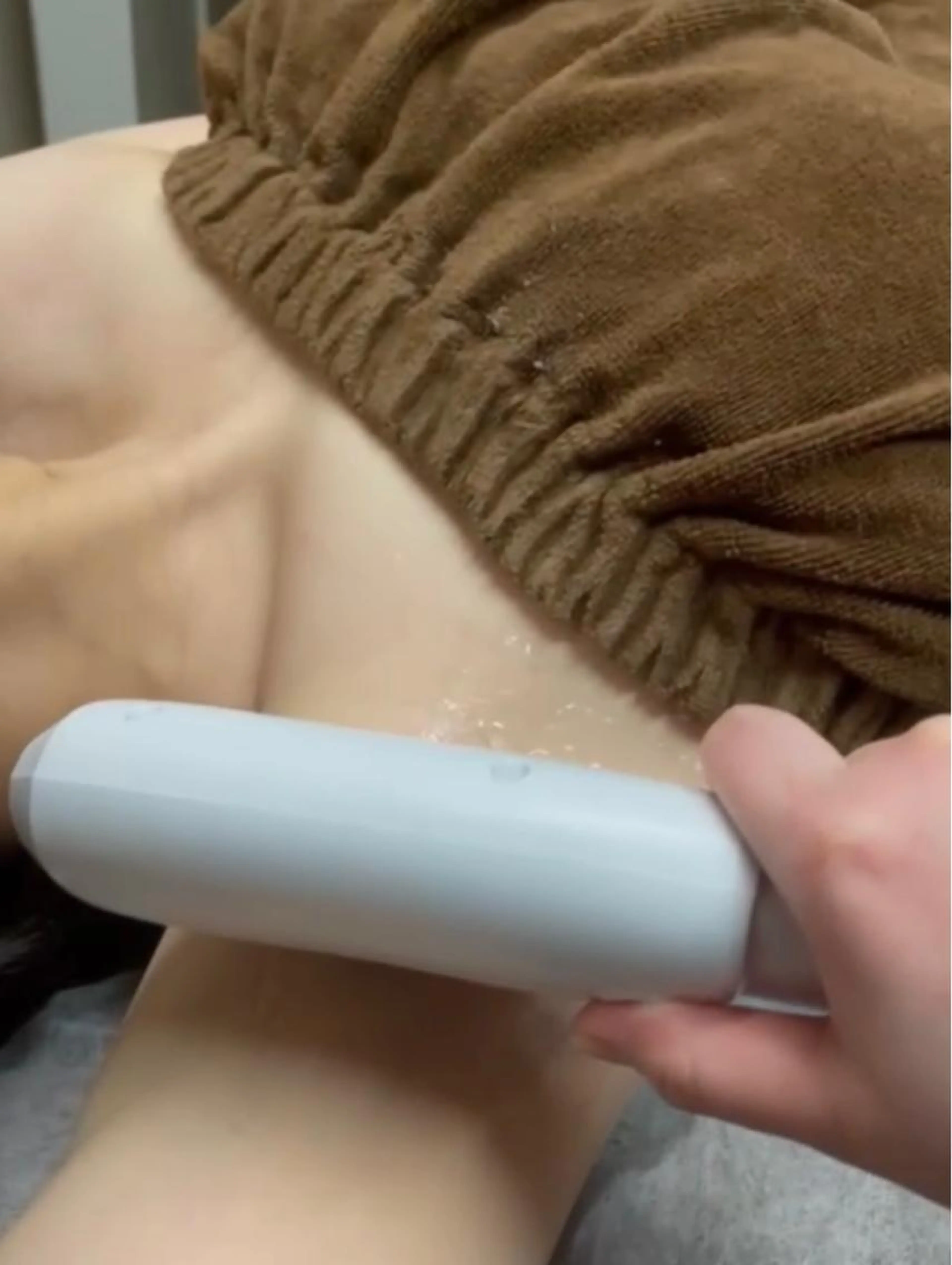 ✨【人気No.6】ハイスペック両脇脱毛 3回 300円の写真