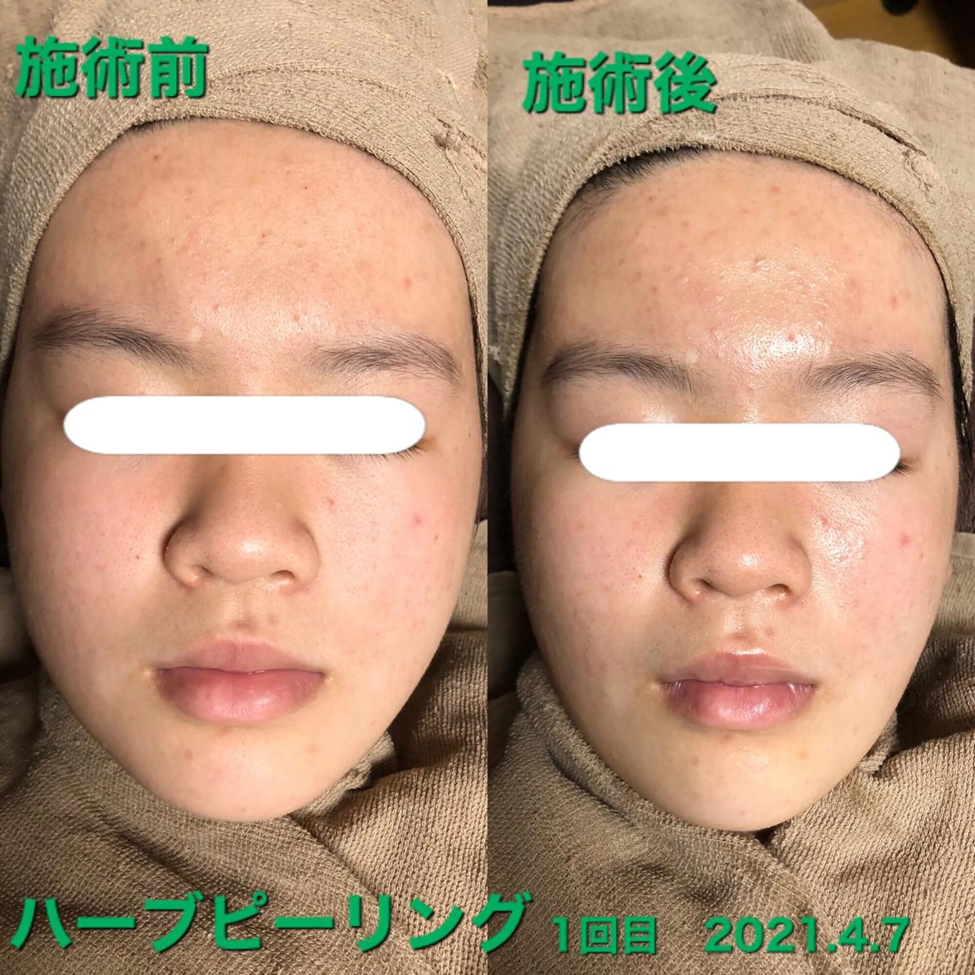 La.pport ラポールのエステ・リラクイメージ