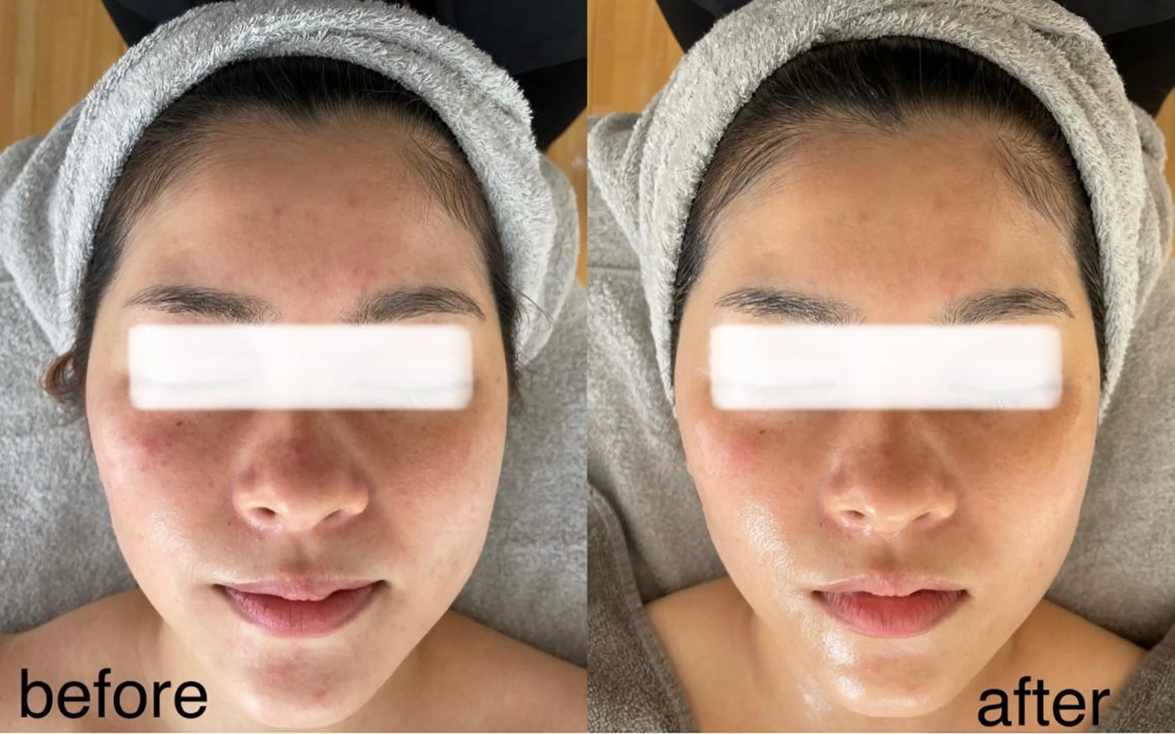 その他 Lavi&所属・肌質改善サロン Ｌａｖｉ＆のその他イメージ