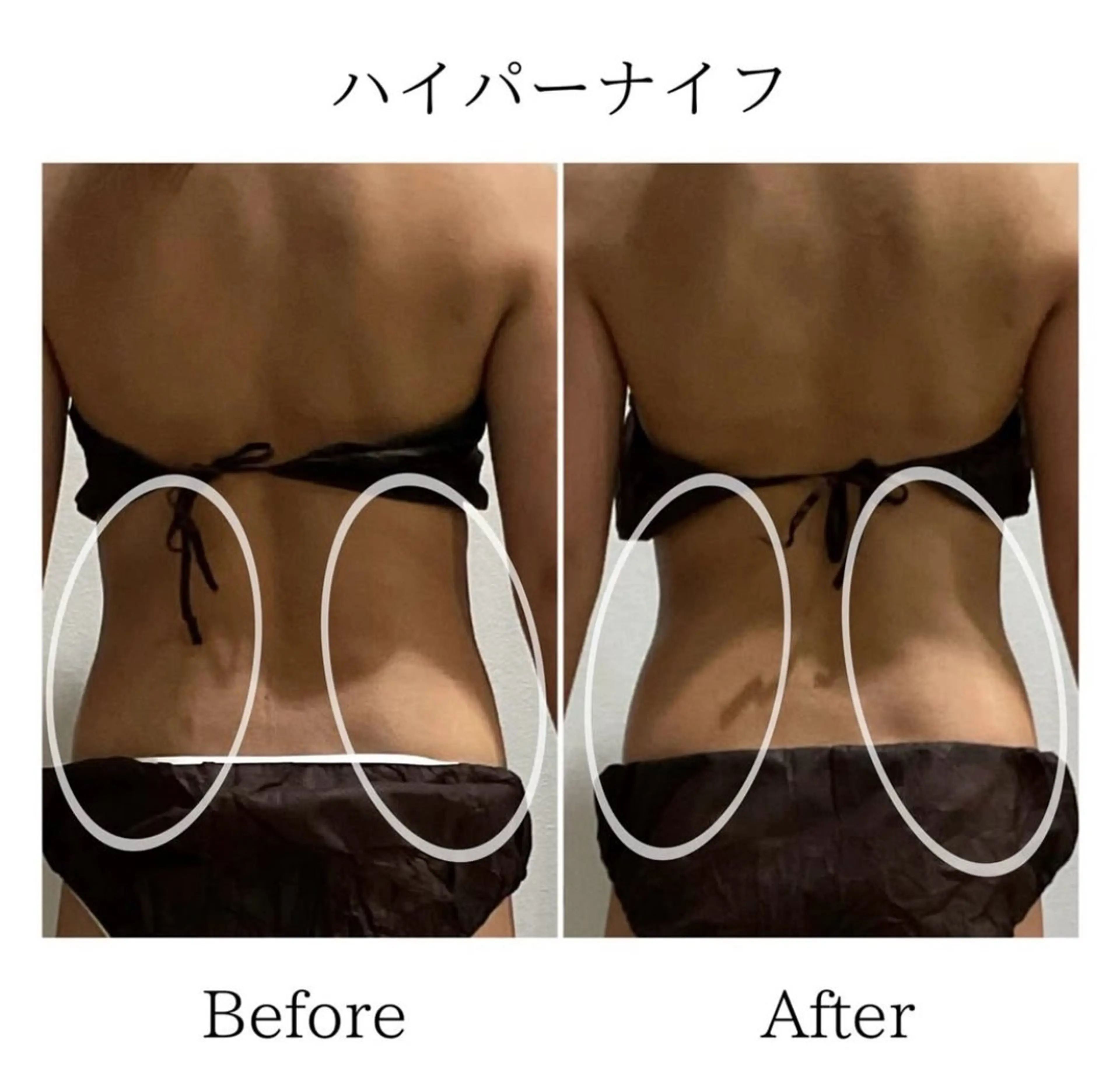 エステ LiLL by Andre beauty所属・LiLL 熊本のエステ・リラクイメージ