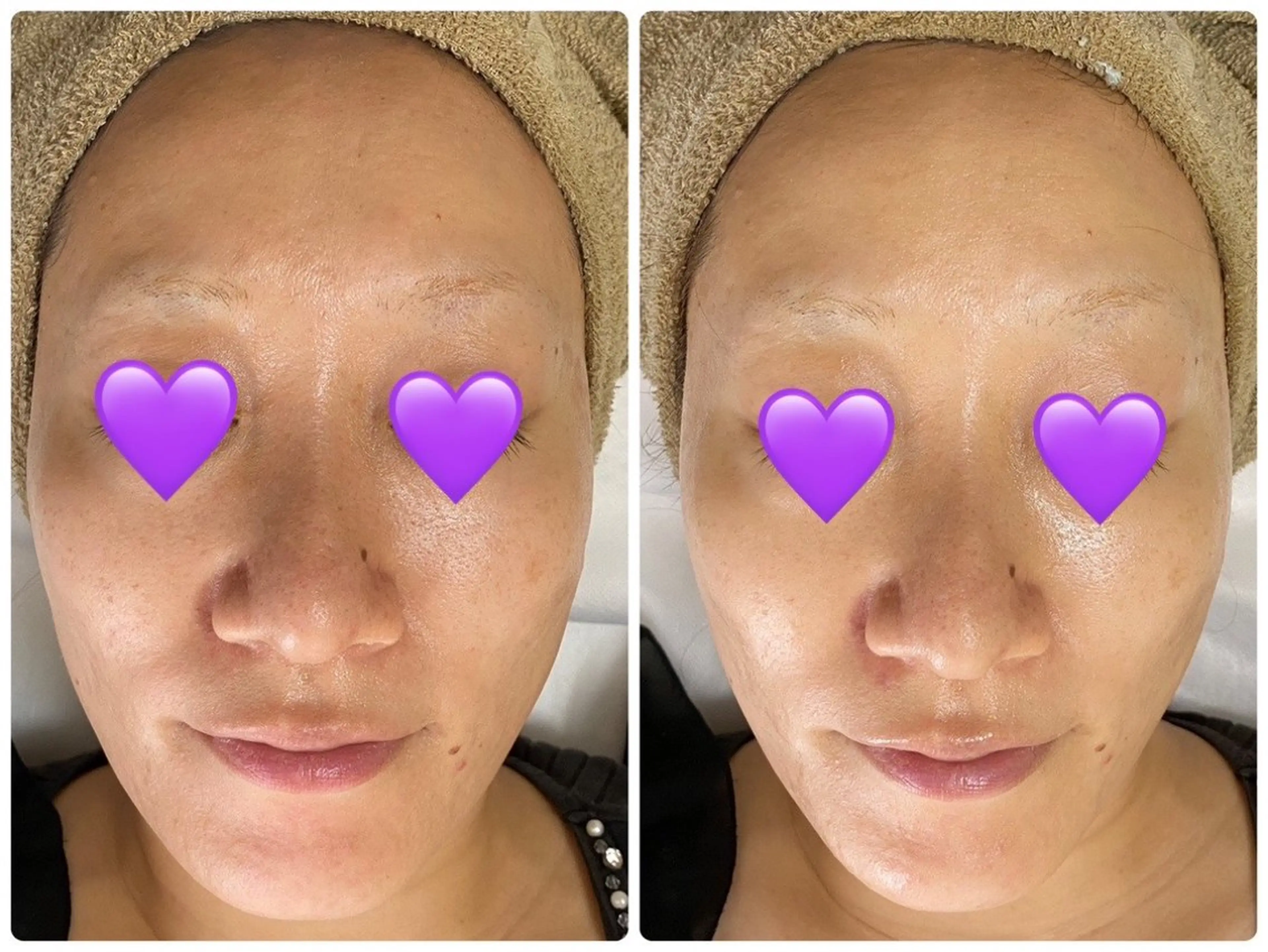 エステ COCO beautyサロンのエステ・リラクイメージ