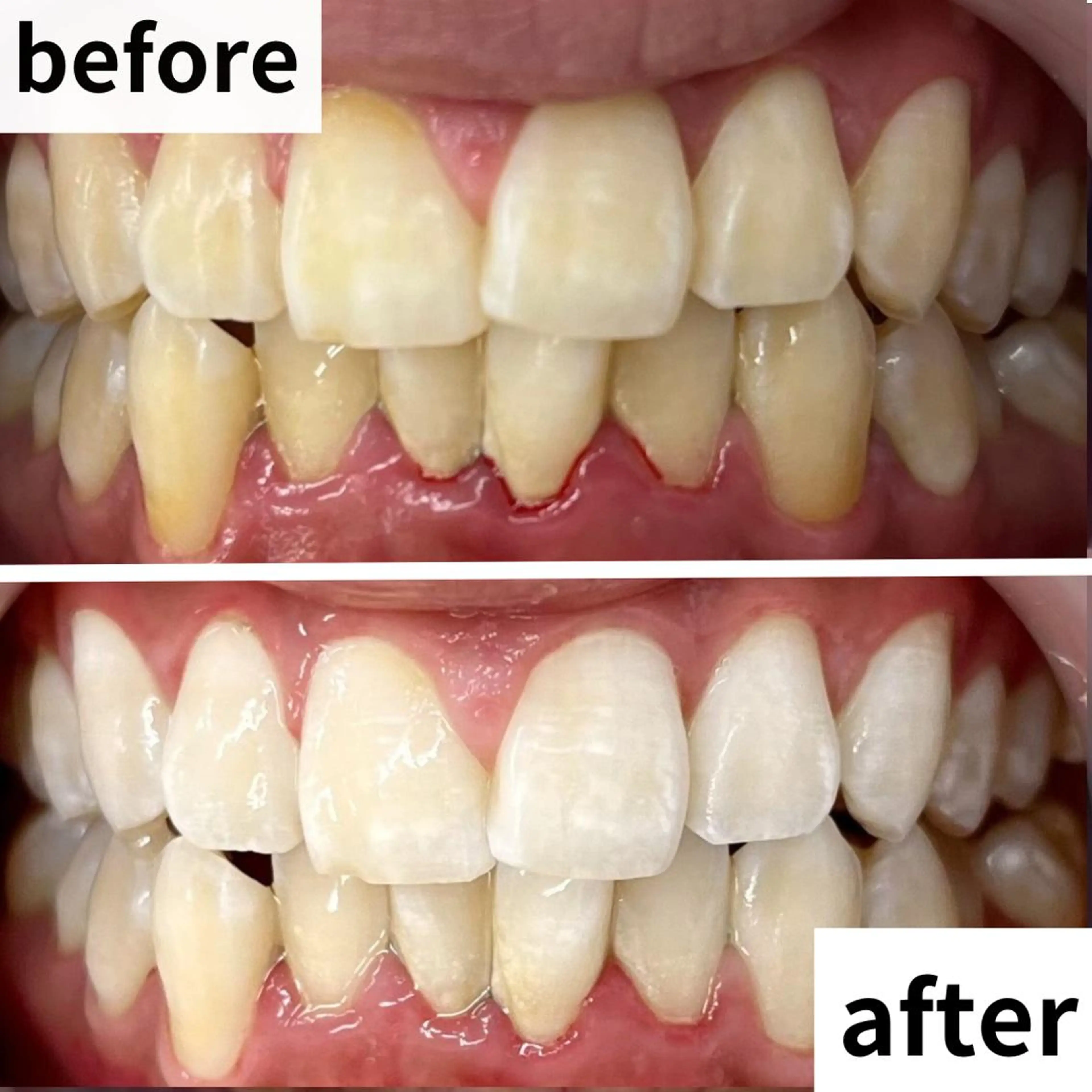 LBSホワイトニング 🌐渋谷店 河内のエステ・リラクイメージ