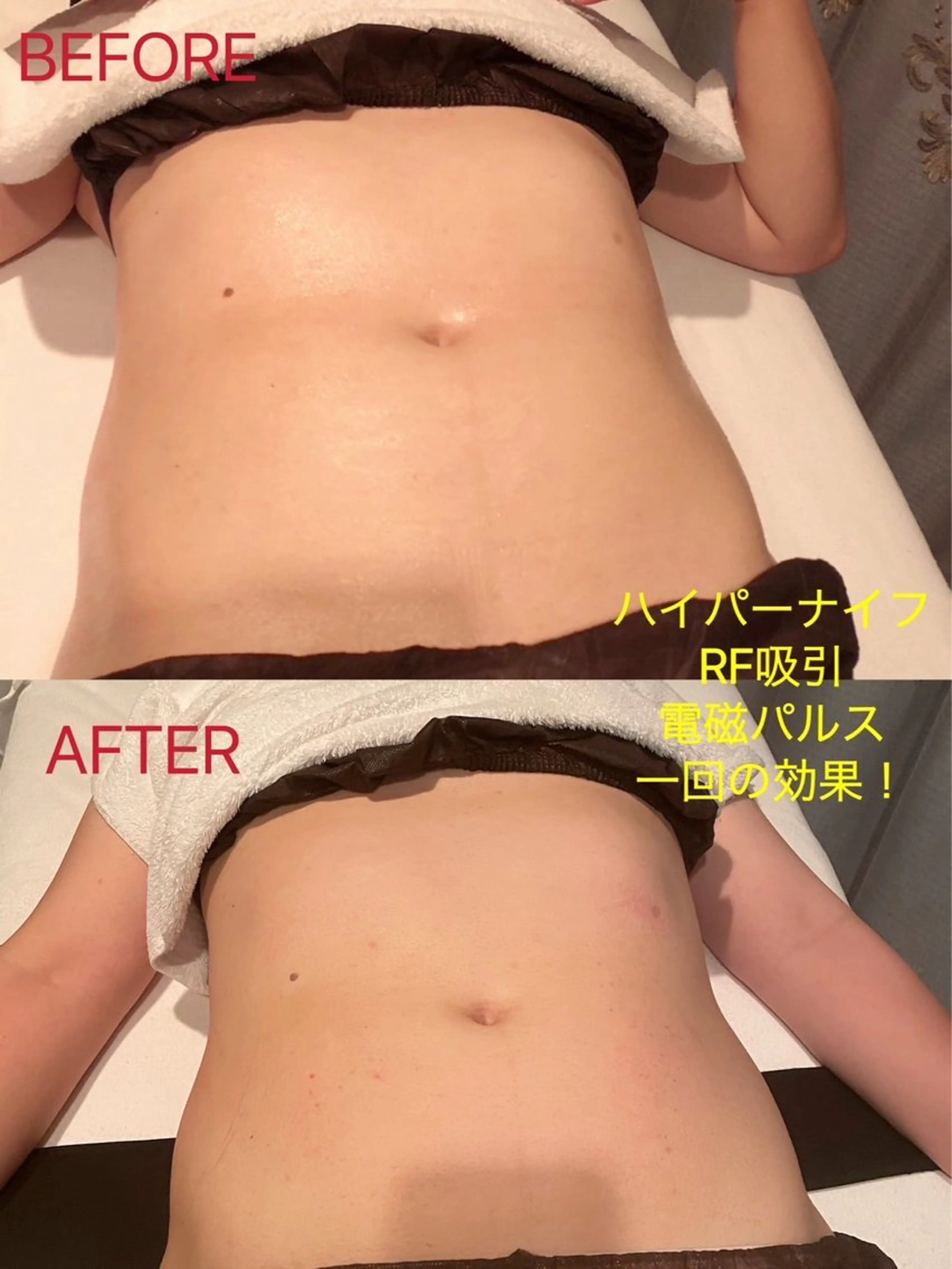 メンズ エステサロン lindyのエステ・リラクイメージ