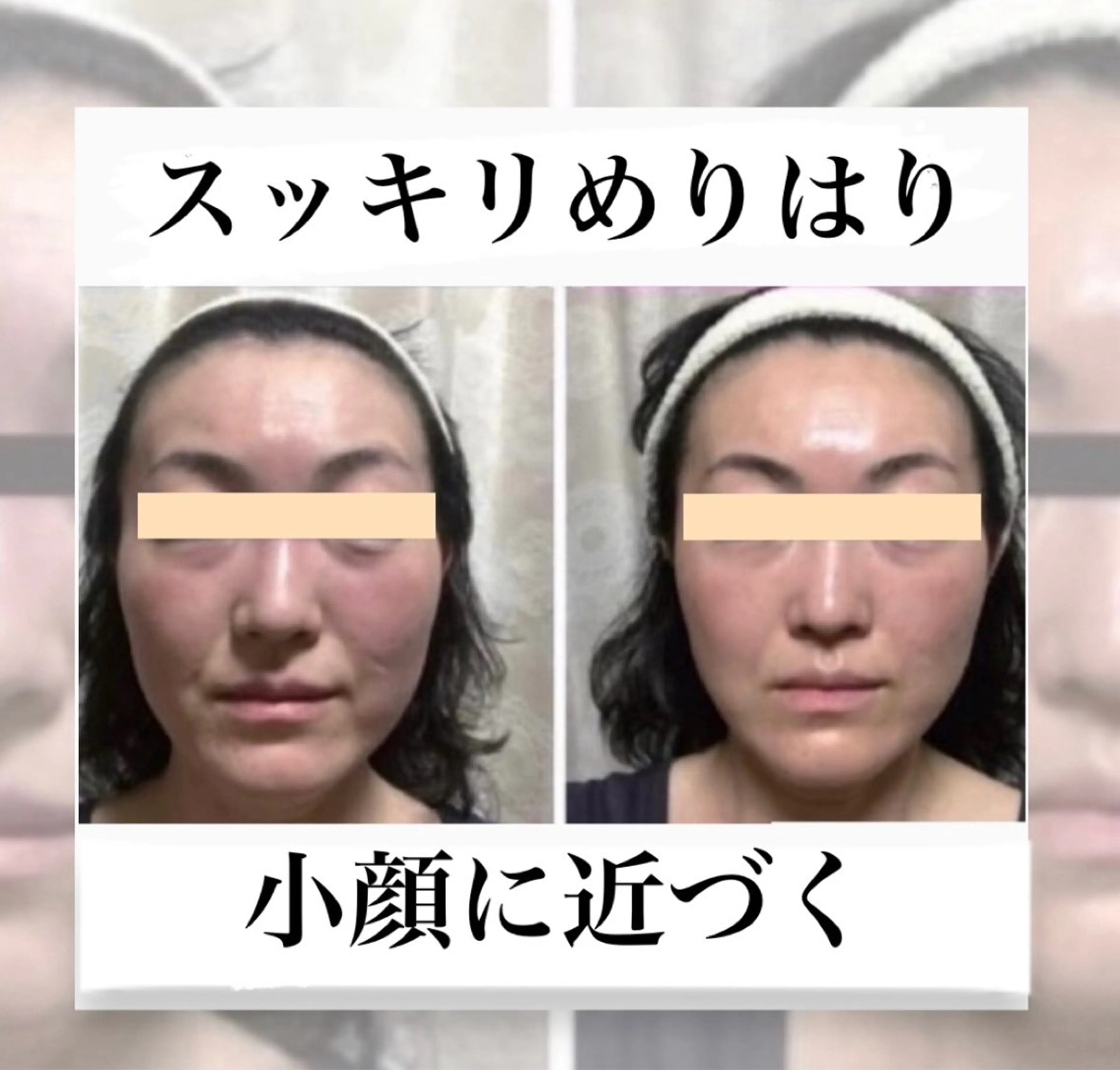 【リフトアップ】肌質改善フェイシャル＋高濃度美容成分の写真