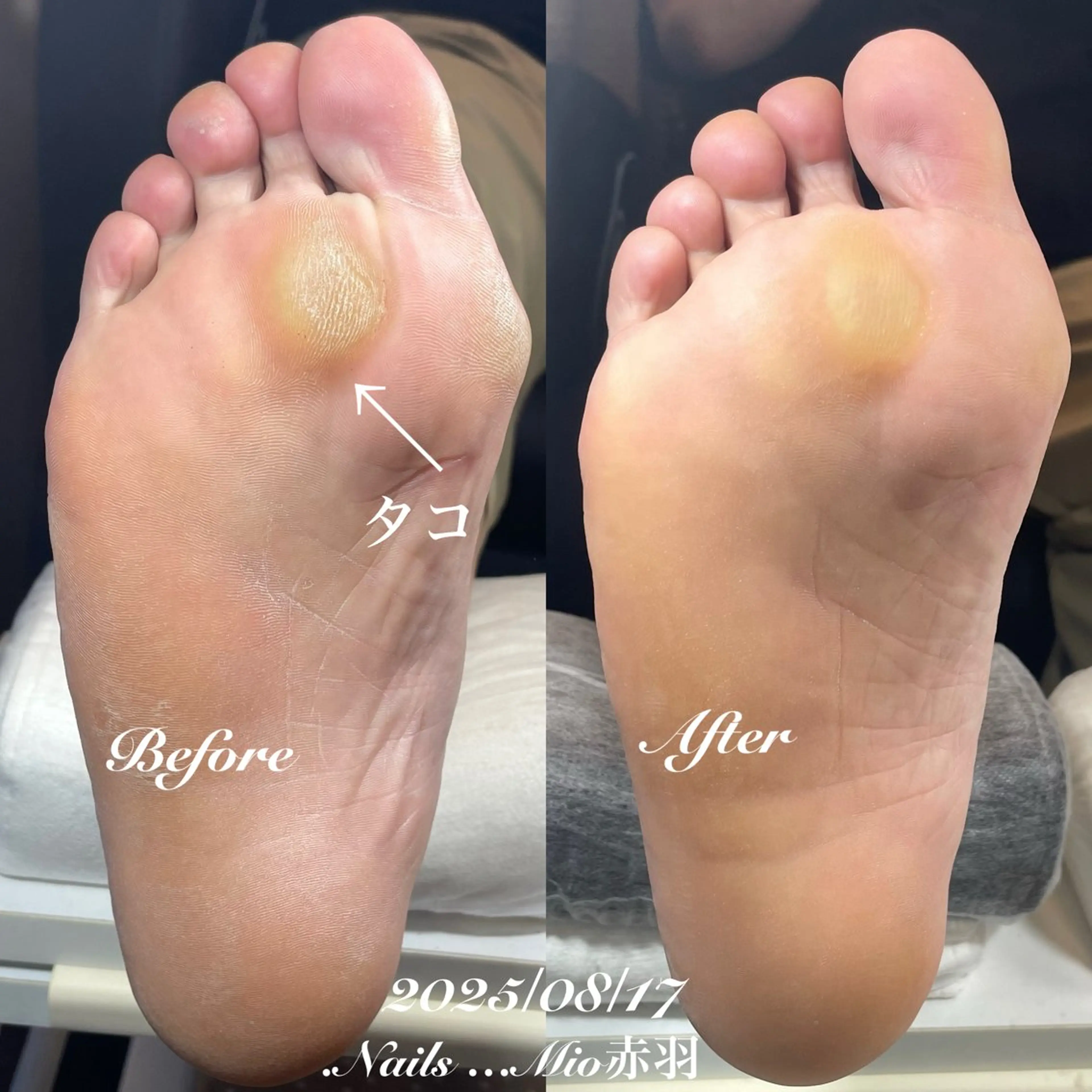 ネイル フットネイル .Nails Mio 赤羽西ネイルサロンのネイルデザイン