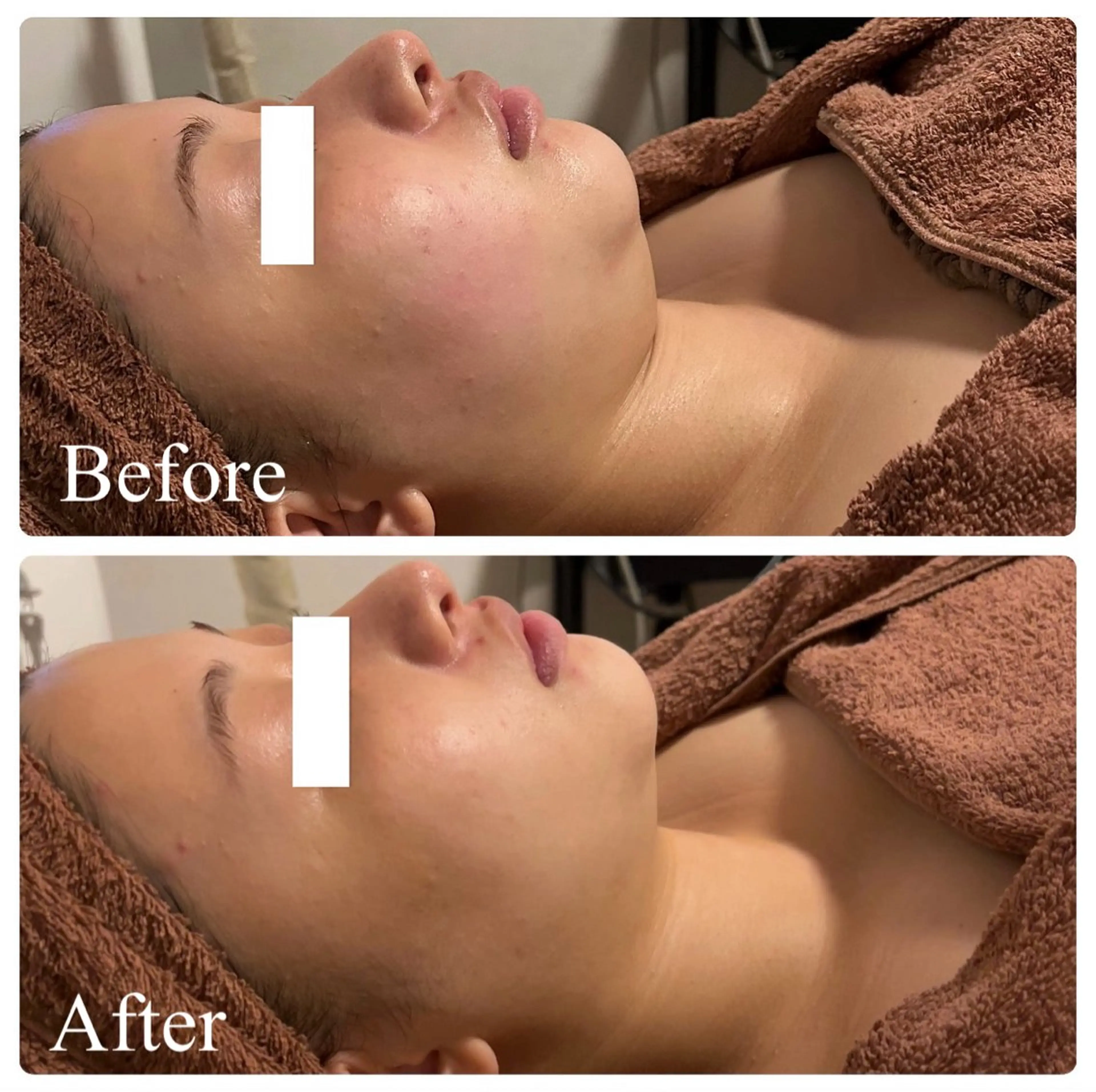 🌴Beauty Salon LANAのエステ・リラクイメージ