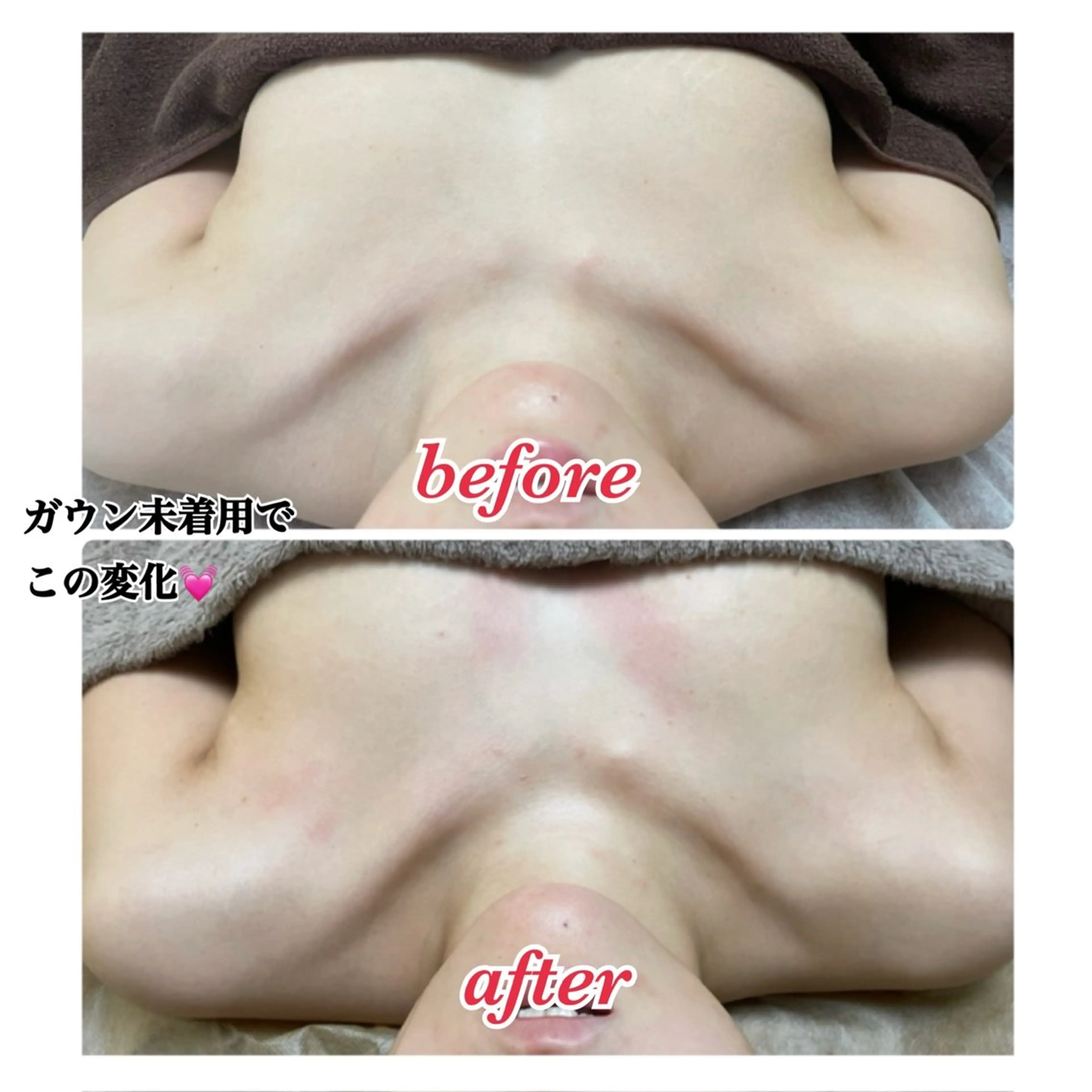 巻き肩、猫背を解消しながら育乳バストへ❣️＆リピート率90%超の小顔矯正✨美乳メソッド×姿勢矯正×小顔矯正の写真