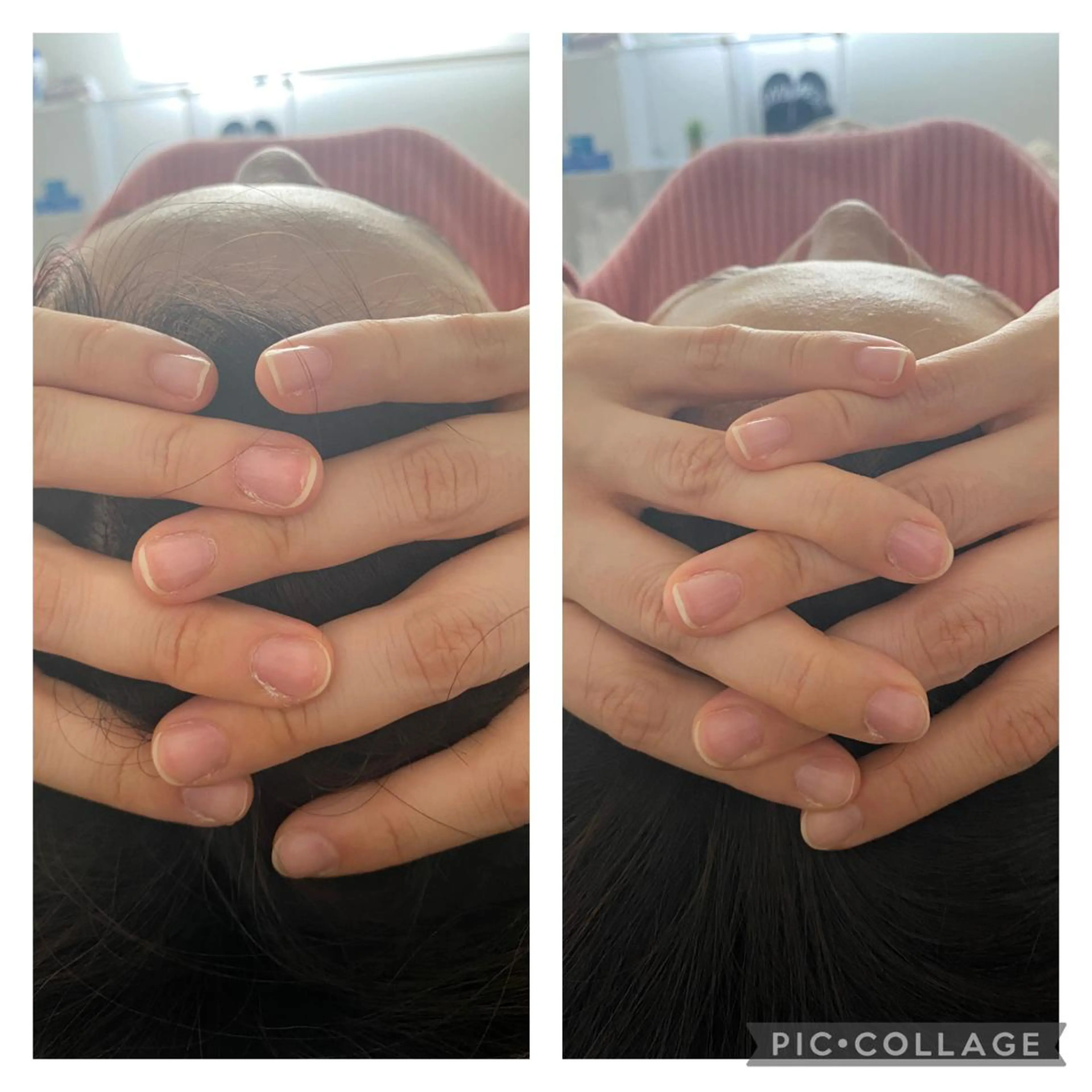 小顔矯正 MEGUMIのエステ・リラクイメージ