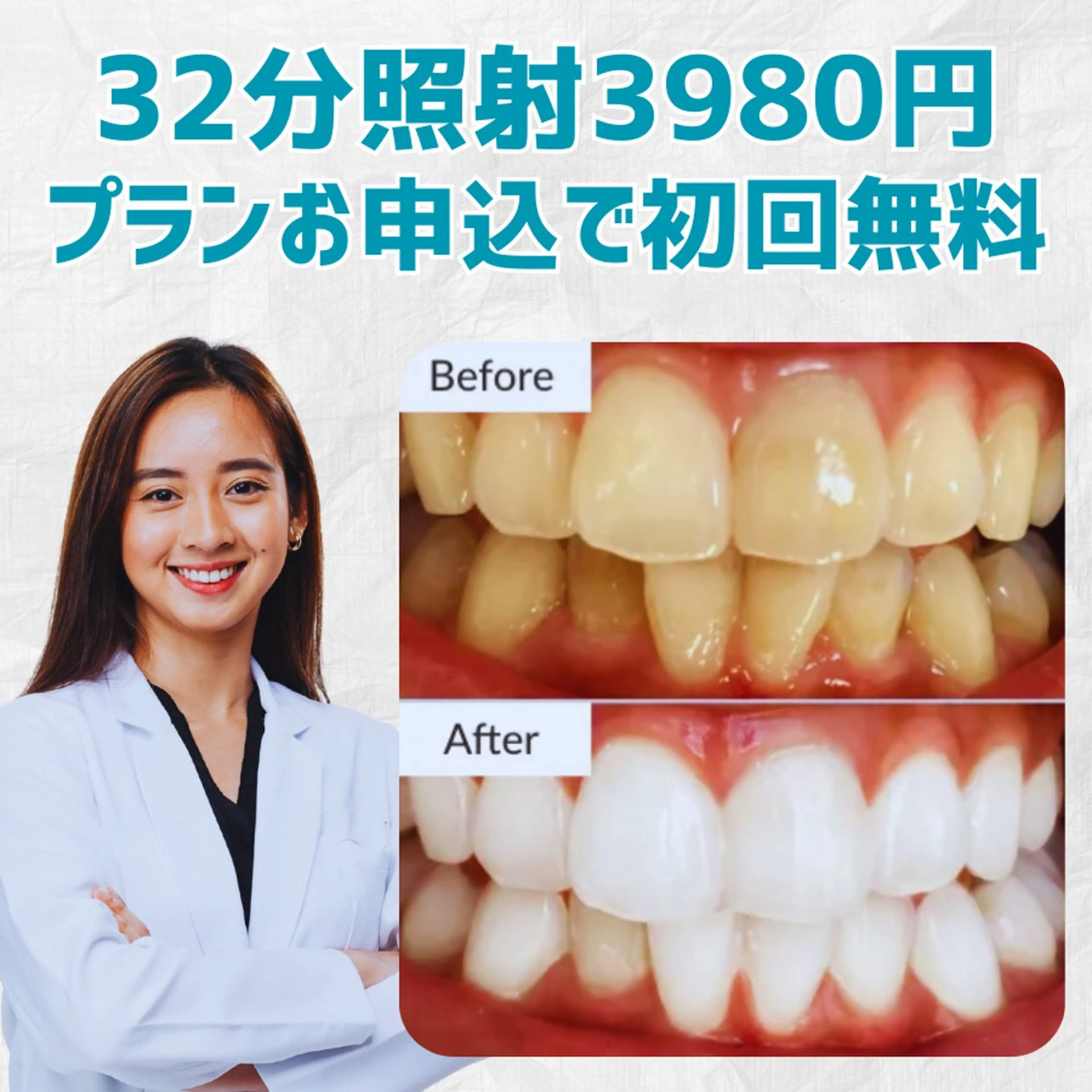 【7300円⇒3980円】国内最高65Wマシン・32分(16分2セット)照射ホワイトニングの写真