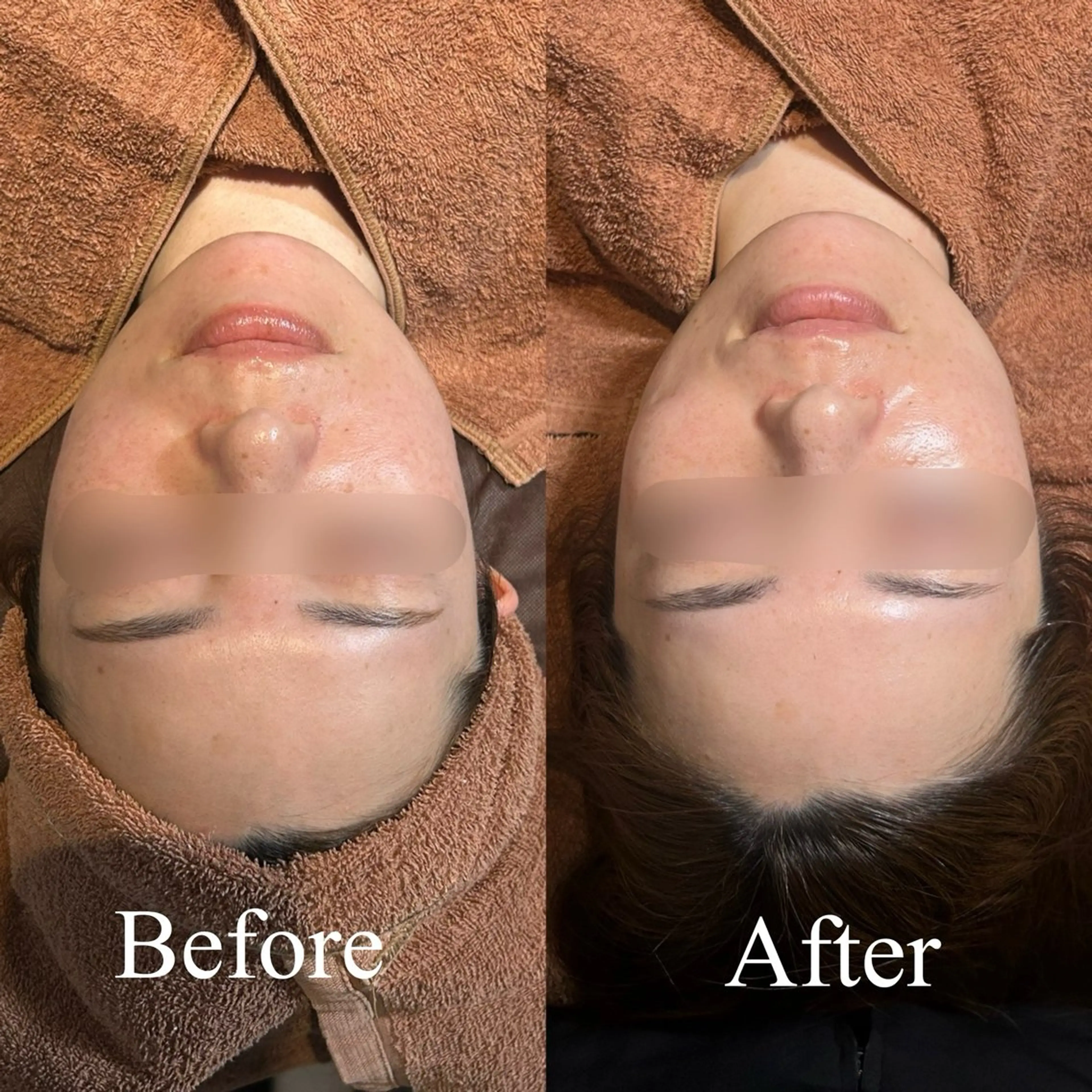 🤍【水玉リフティングコース】🤍韓国でも今話題🇰🇷💗ㅎㅎこの夏お肌悩み🤔💭ゼロの肌へ🧏🏻‍♀️💖の写真