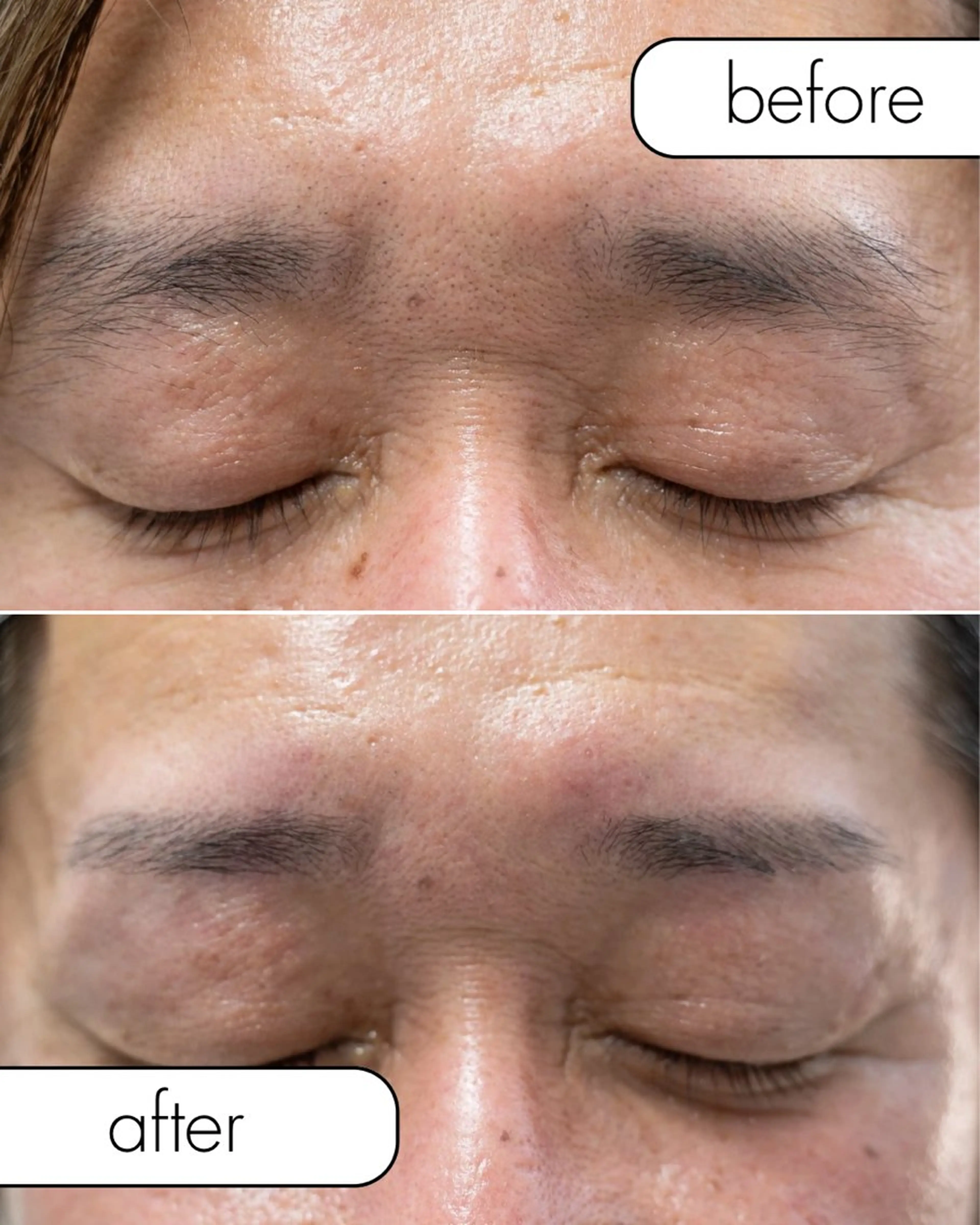 アイブロウ 眉毛ワックス脱毛 松下 佳織の眉毛・アイブロウイメージ