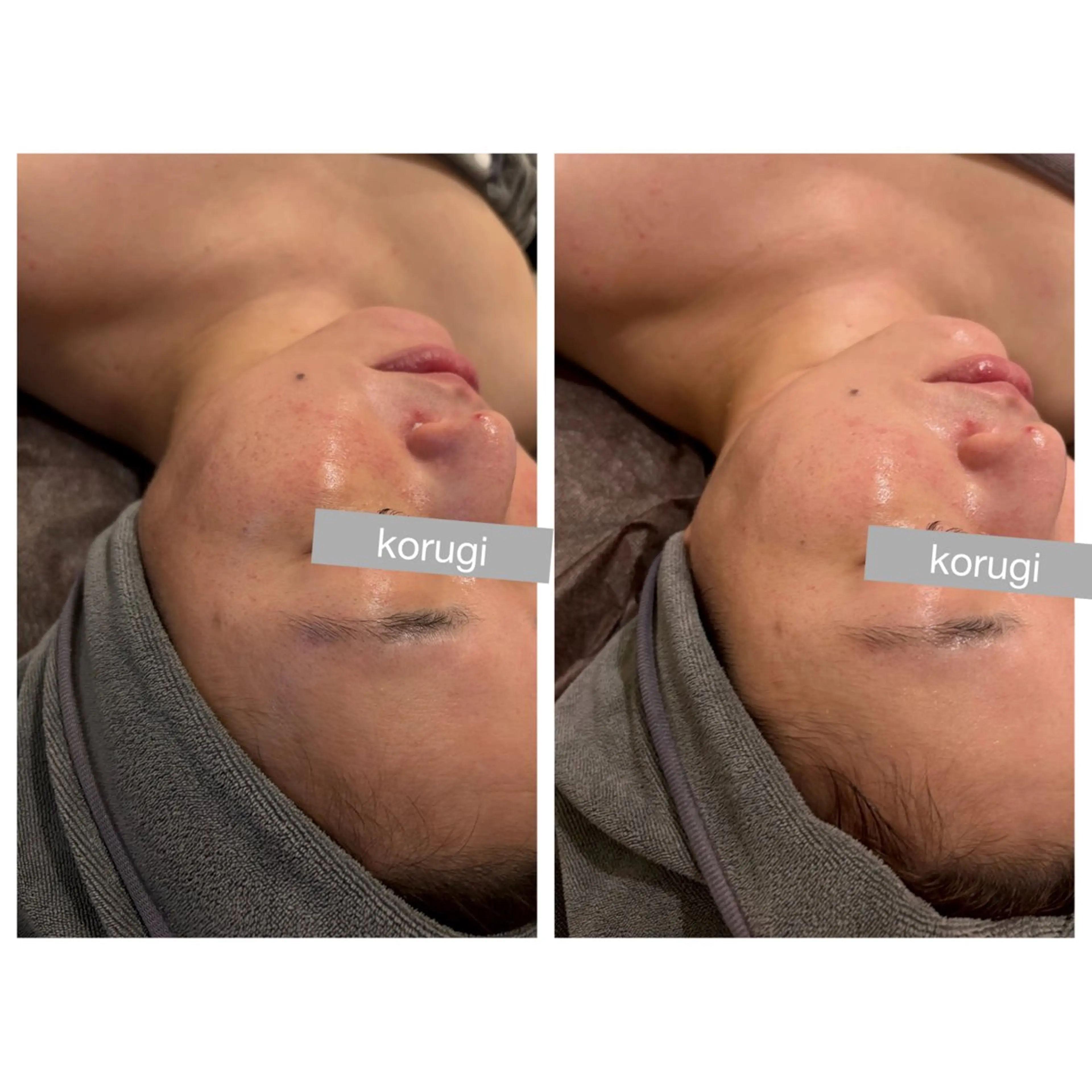 小顔コルギ ☆表参道/外苑前のエステ・リラクイメージ