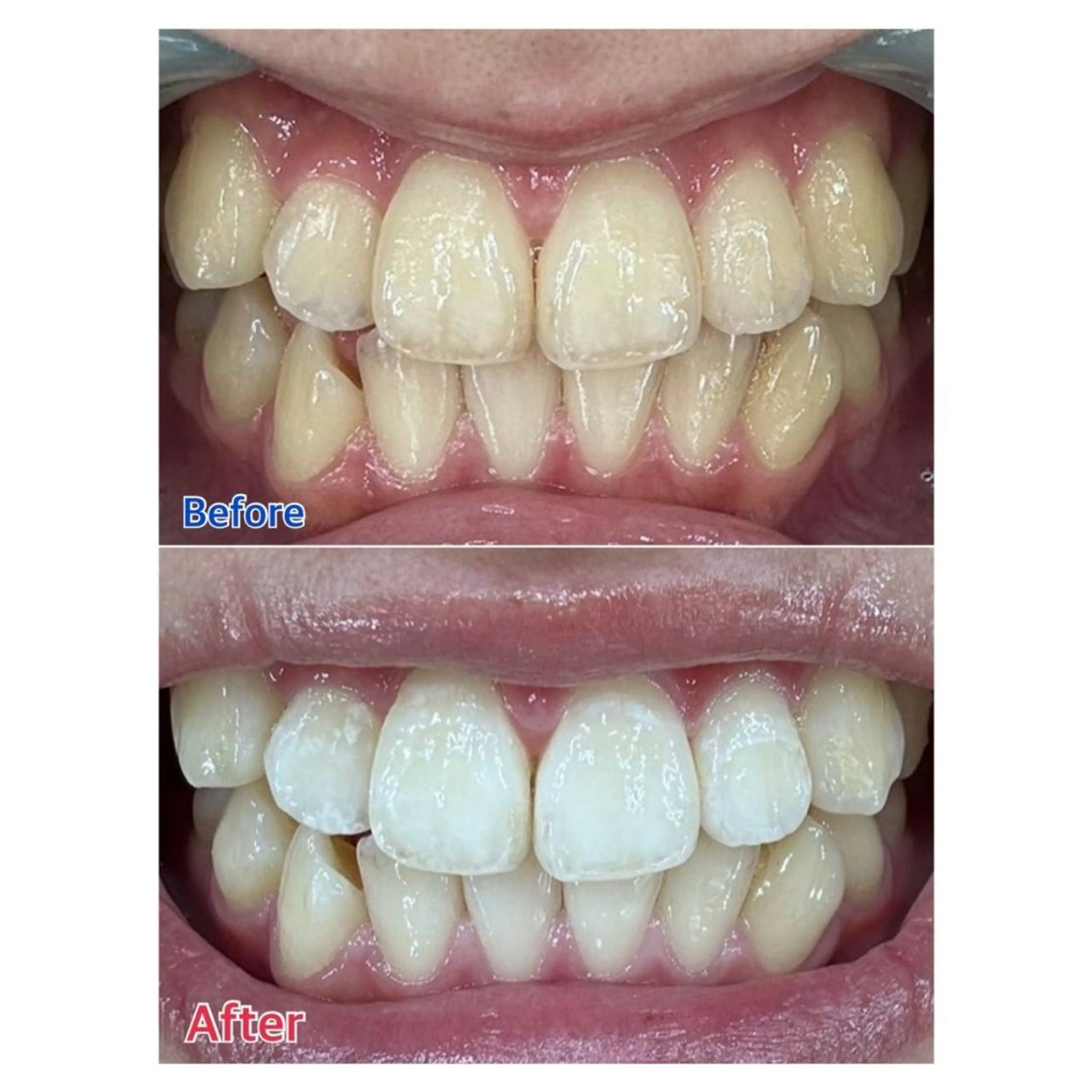 Melty 輝のその他イメージ