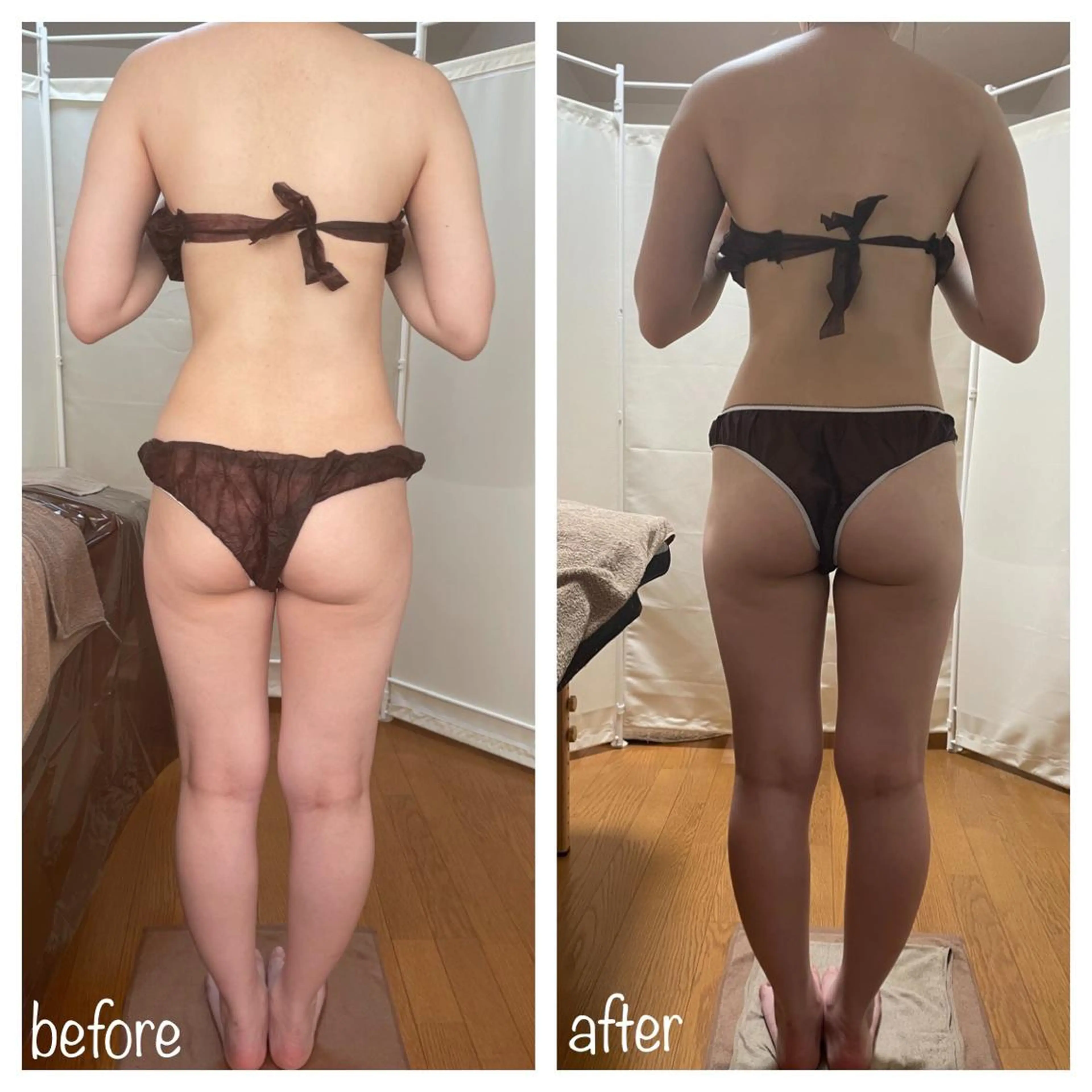 《本気痩せ×疲労改善 》  BILOOPのエステ・リラクイメージ