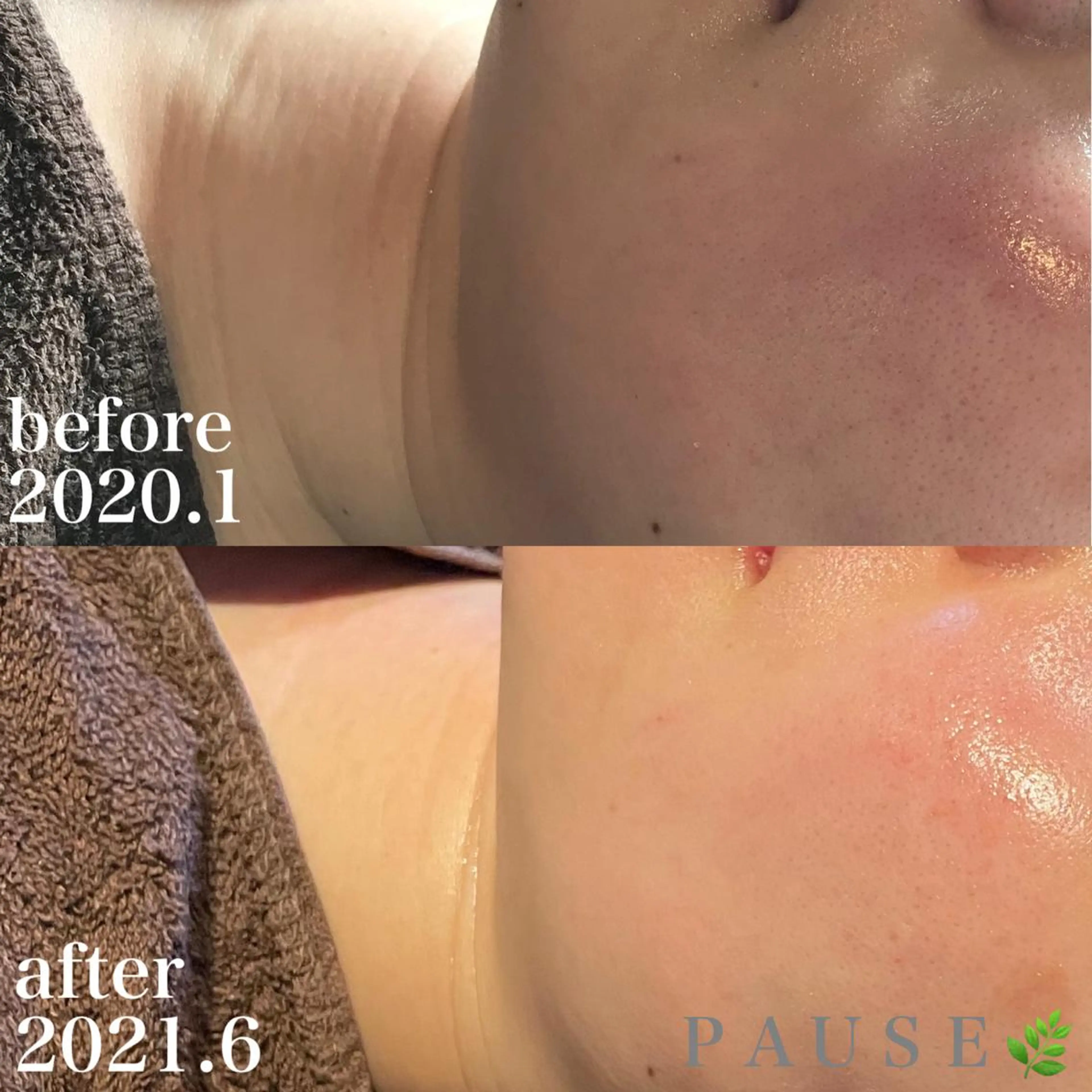 エステ 浜野 恵美のエステ・リラクイメージ