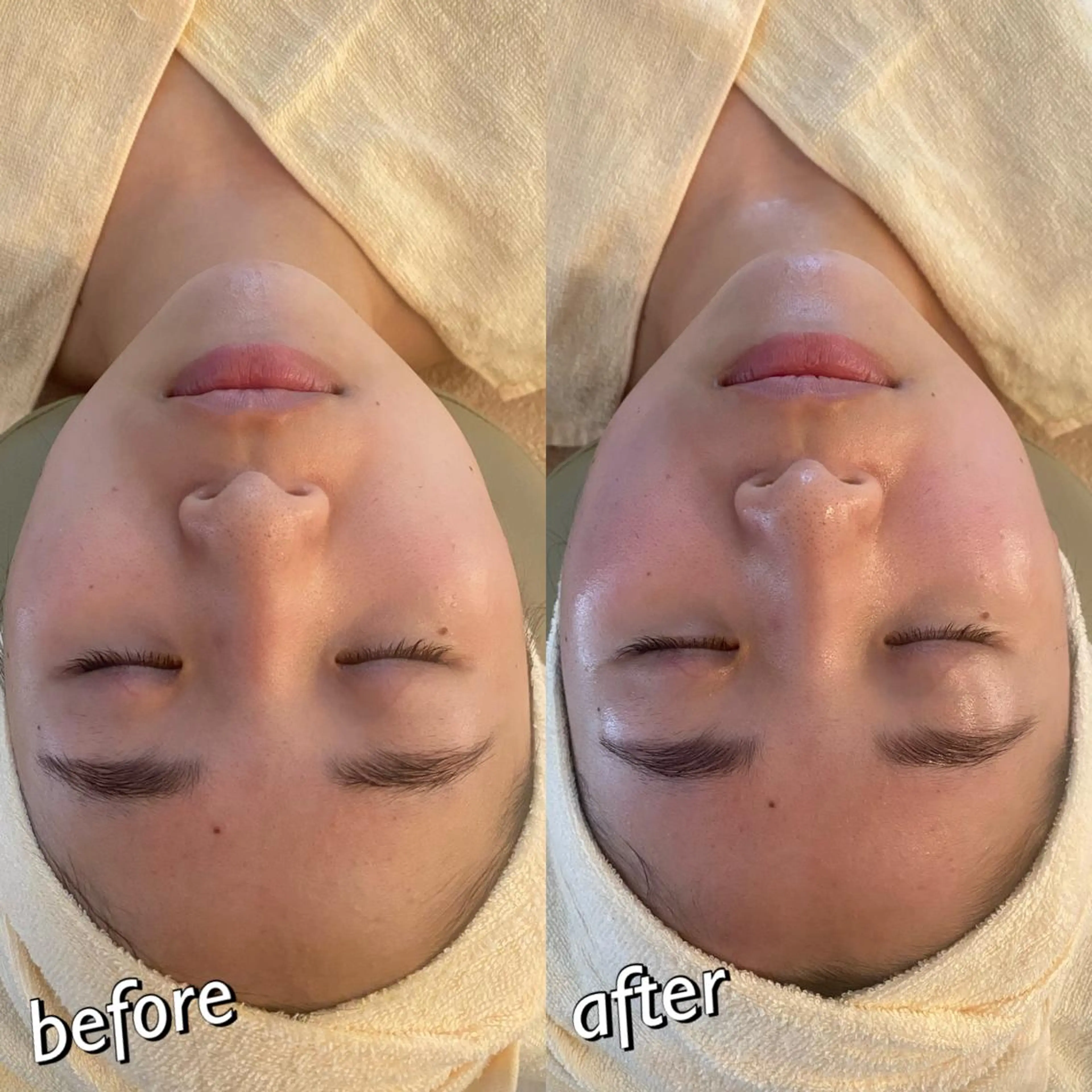 うなじ脱毛/美肌脱毛 LABELのエステ・リラクイメージ