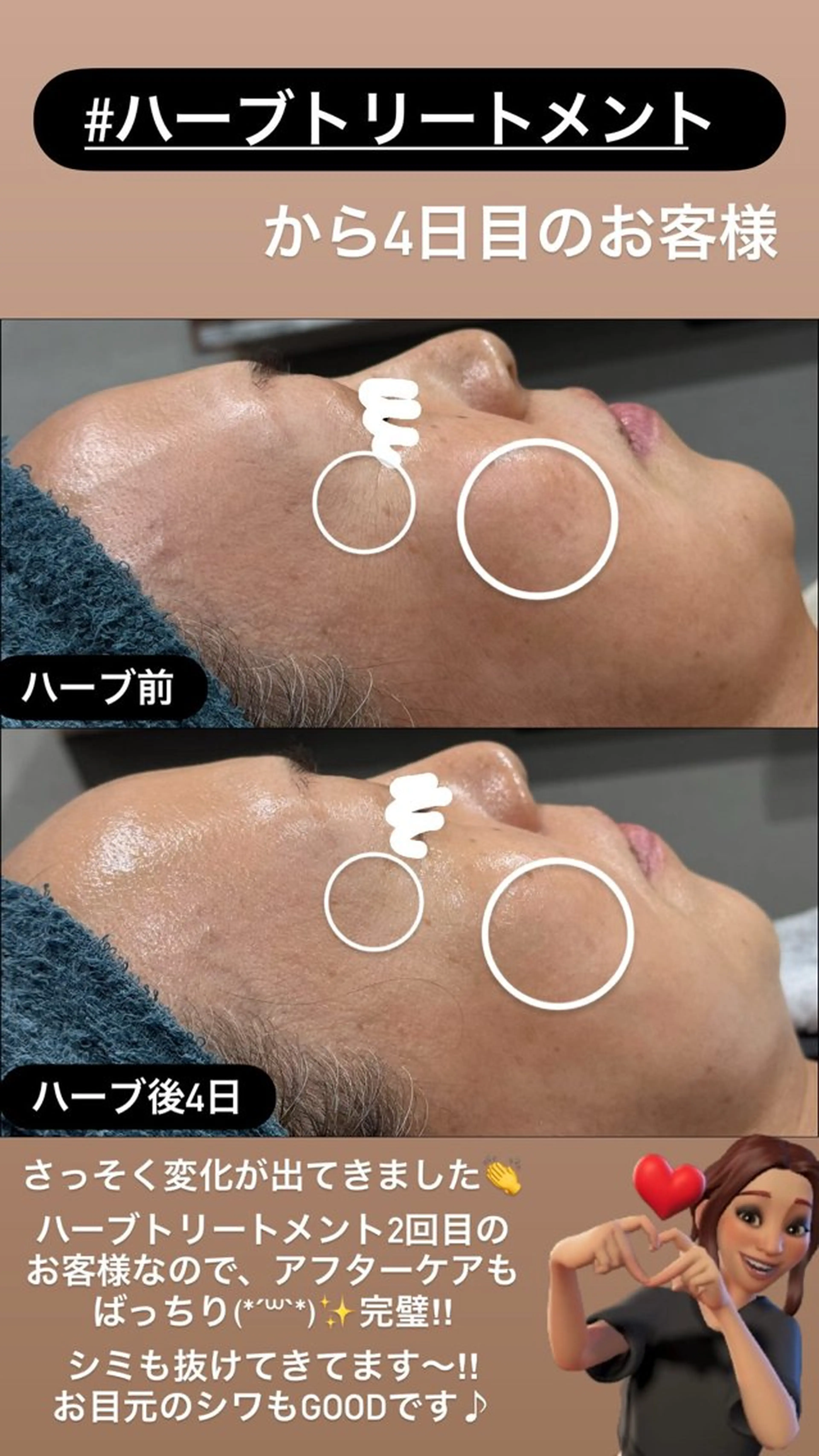 エステ LiZA エステティックサロンのエステ・リラクイメージ