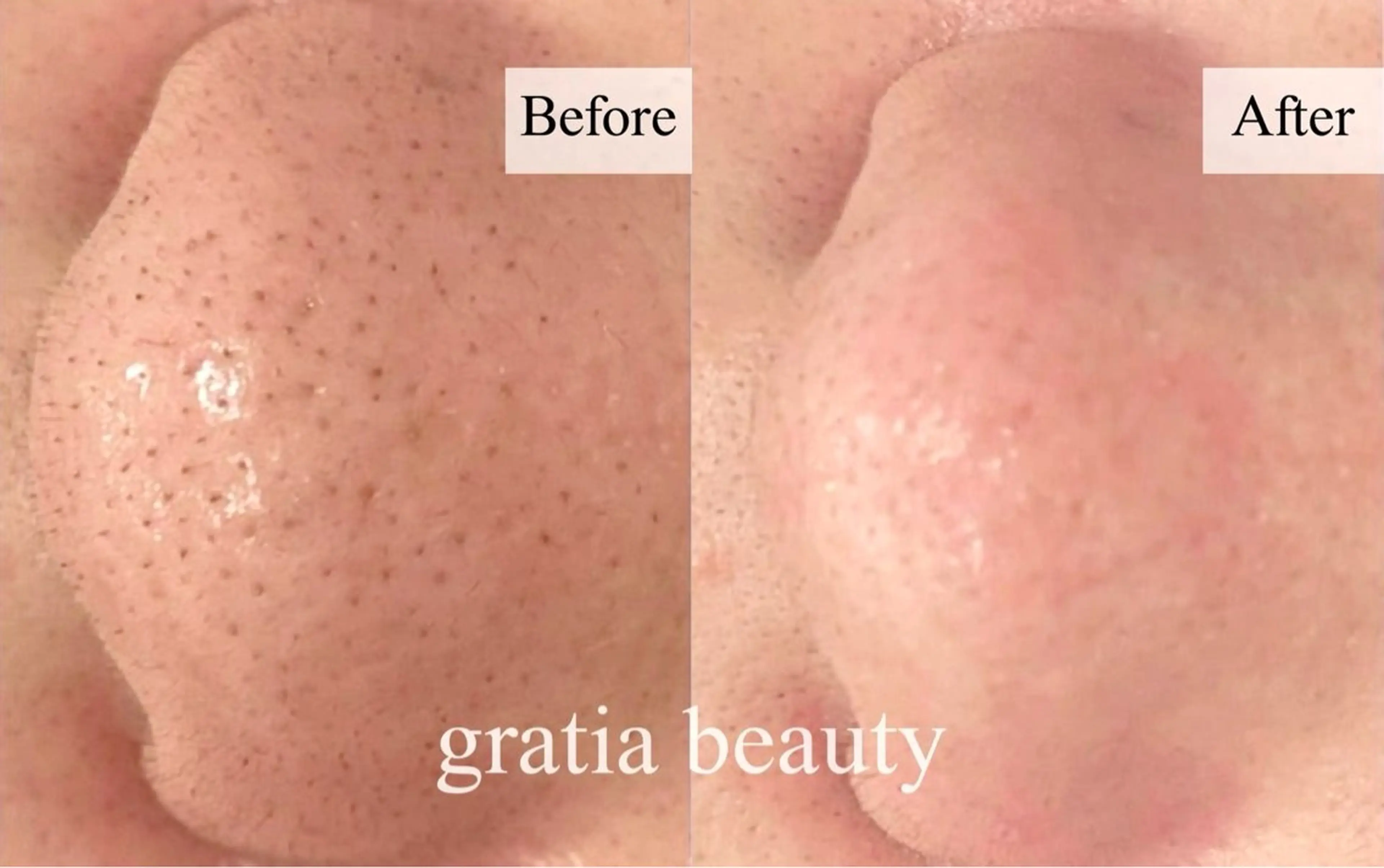 エステ gratia salonのエステ・リラクイメージ