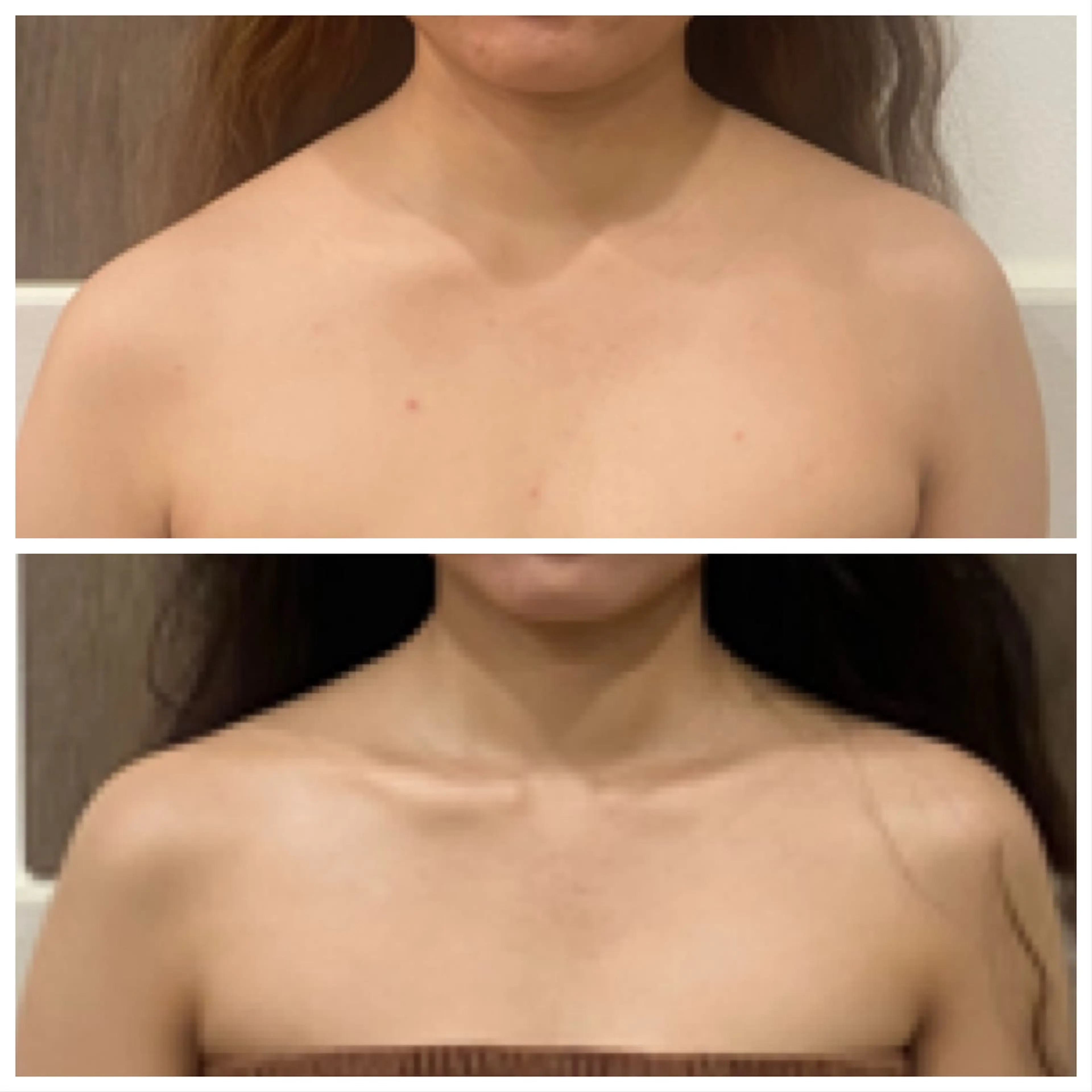 【小顔矯正】 salonaceのエステ・リラクイメージ