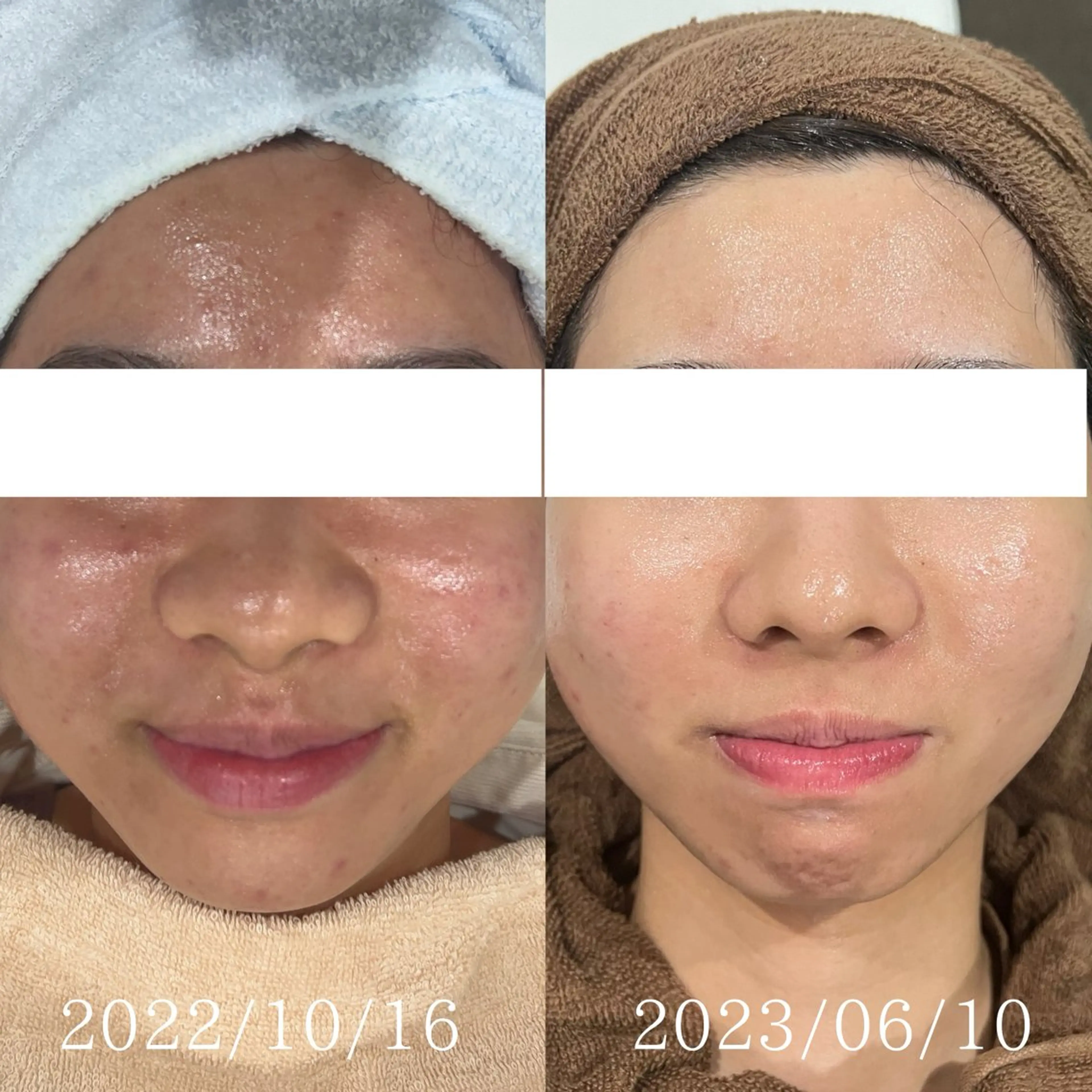 エステ De'Im福井店所属・【福井シェアサロン】 青木優奈のエステ・リラクイメージ